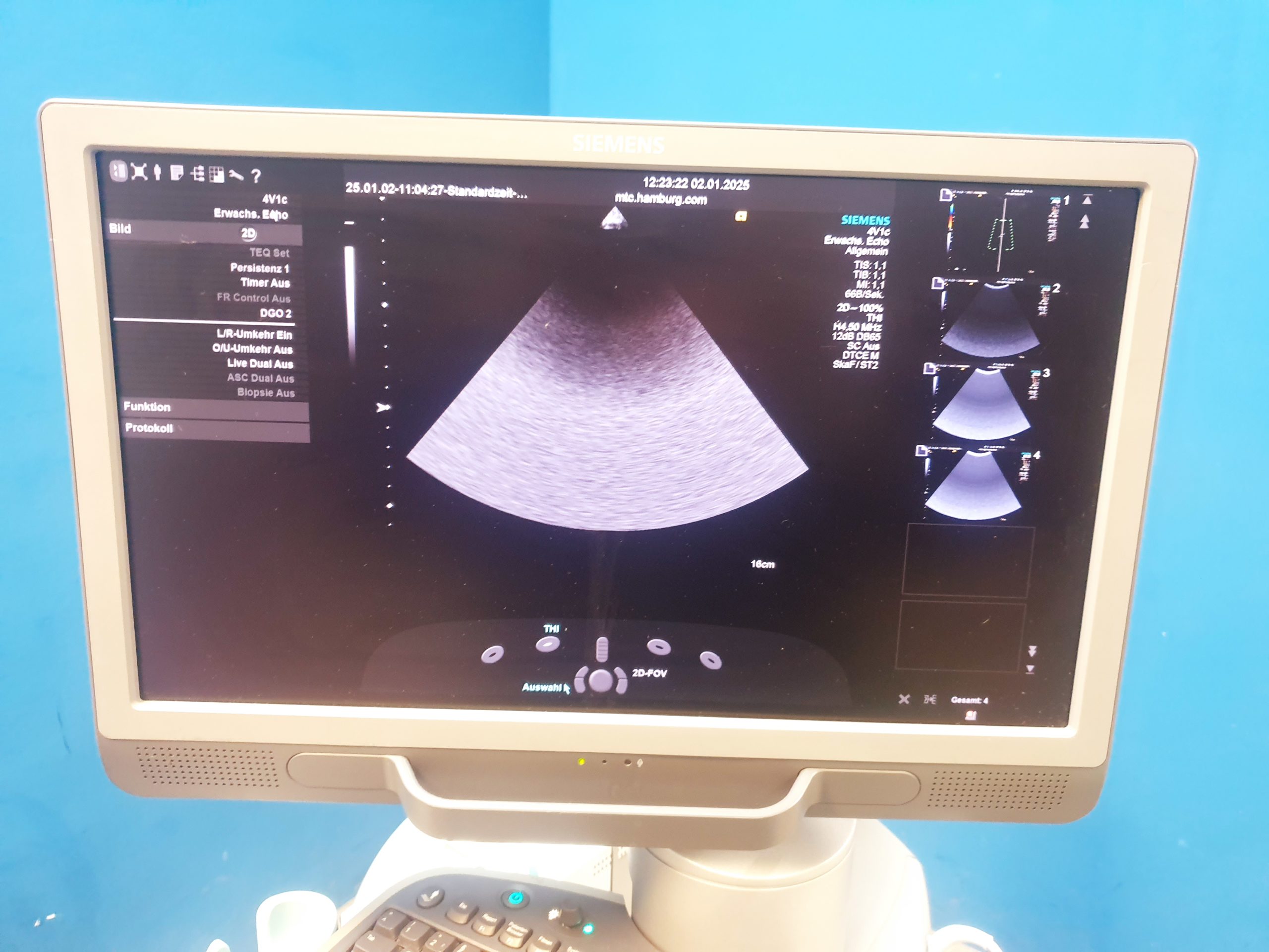 Siemens Acuson S2000 Doppler + 6C1HD + 4V1c Vector Array + 9L4 thumbnail 13