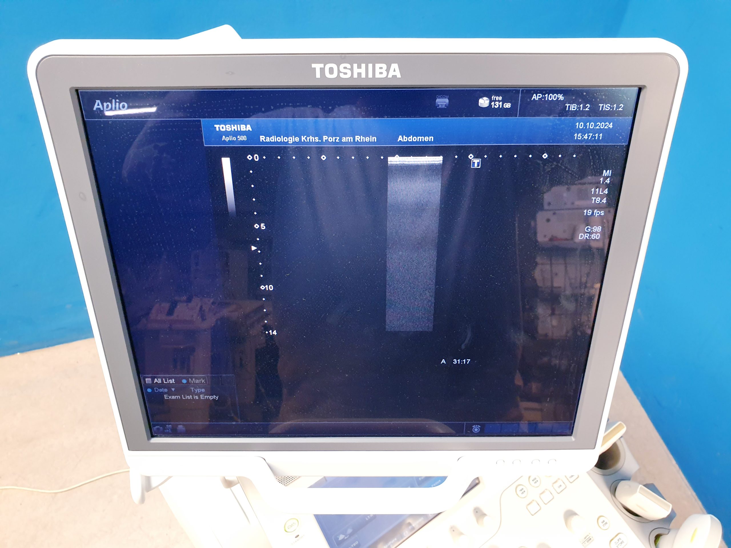 Toshiba Aplio 500 + 6C1 – PVT-375BT + 11L4 – PLT-704SBT + 12L5 PLT-805AT thumbnail 11