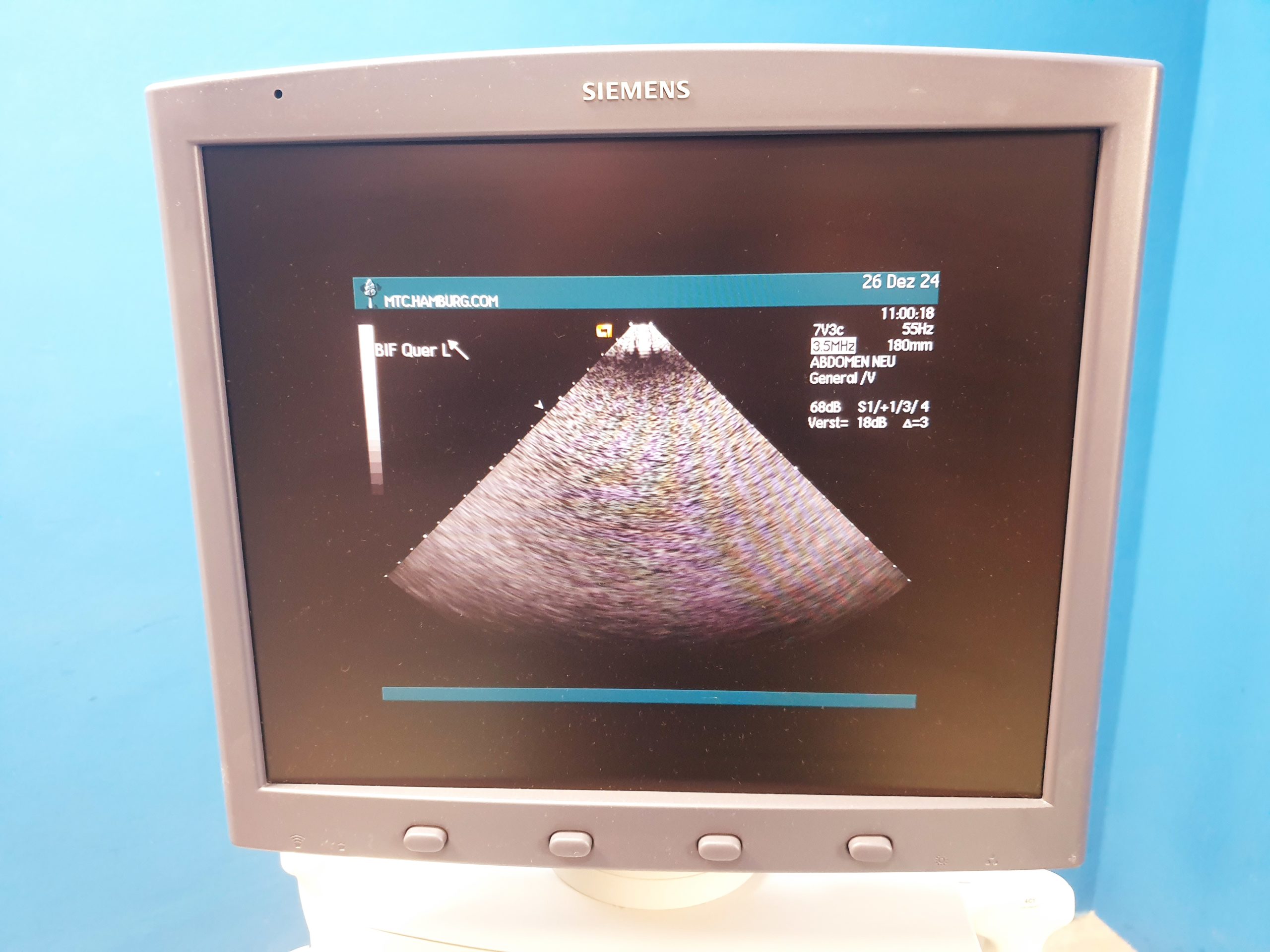 Siemens ACUSON 7v3c Ultraschall-Schallkopf Sonde thumbnail 4