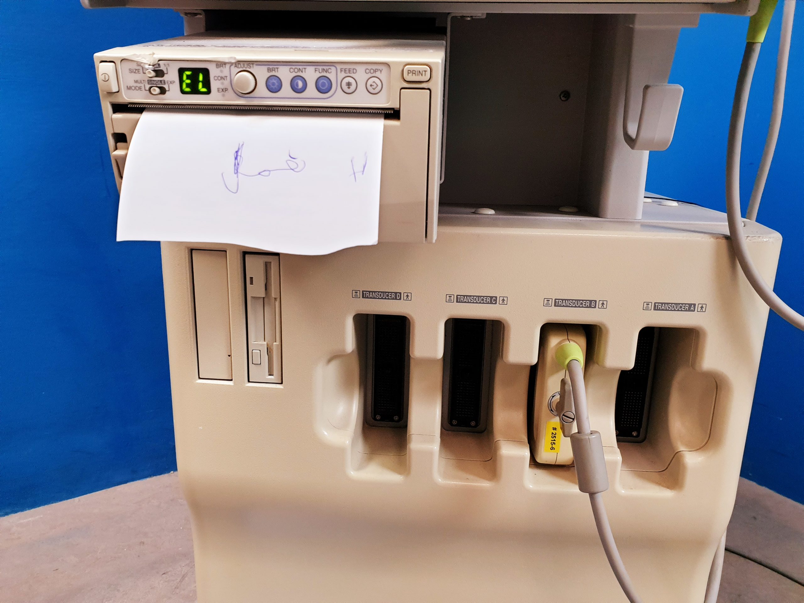 Toshiba Nemio SSA-550A mit Konvex Sonde thumbnail 4