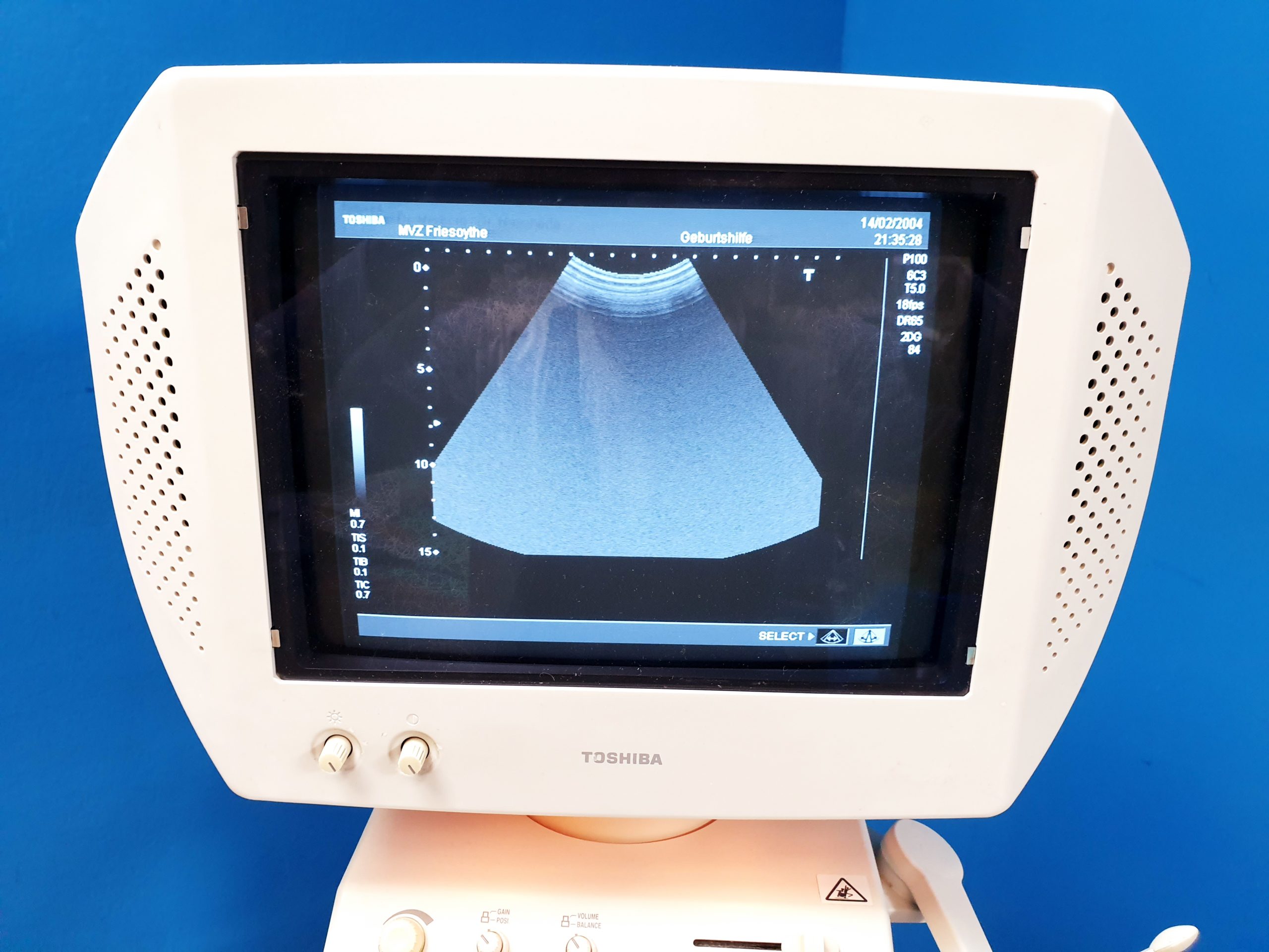 Toshiba Nemio SSA-550A mit Konvex Sonde thumbnail 6