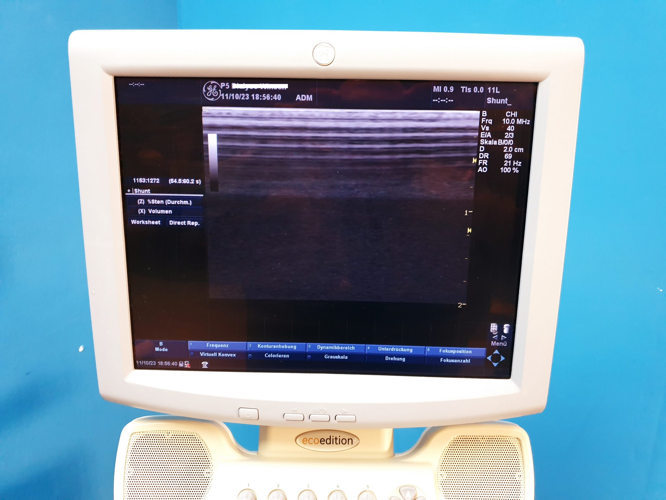 GE Logiq P5 Doppler Farbdoppler + 4C + 11L thumbnail 5