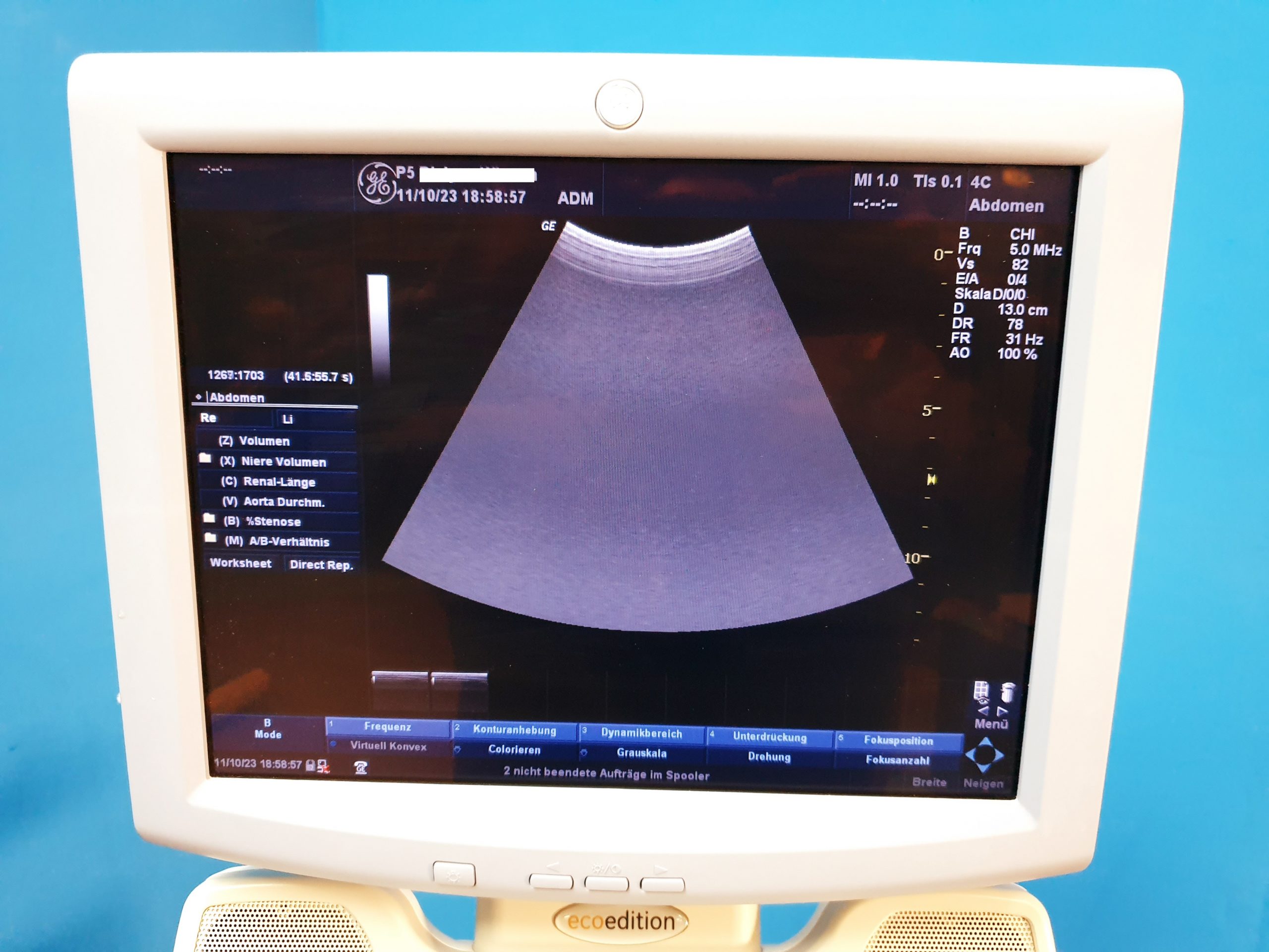 GE Logiq P5 Doppler Farbdoppler + 4C + 11L thumbnail 10