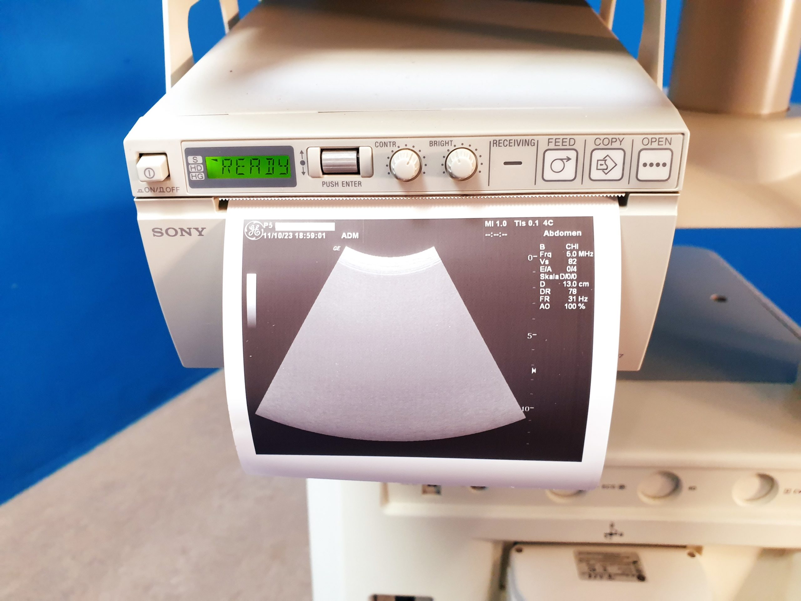 GE Logiq P5 Doppler Farbdoppler + 4C + 11L thumbnail 11