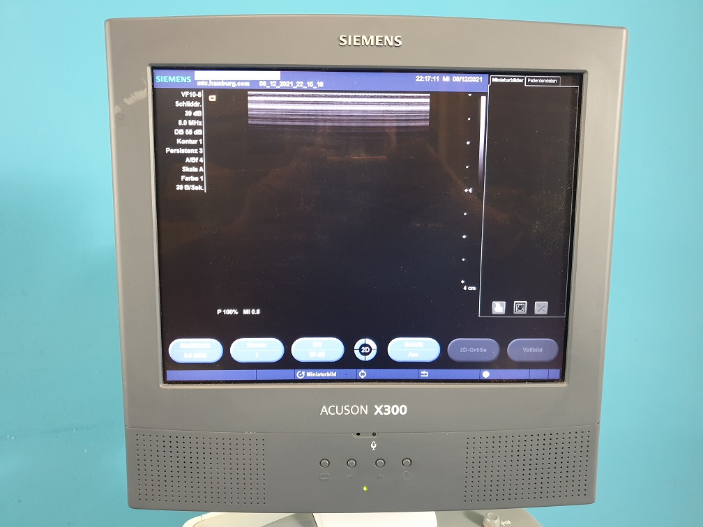 Siemens X300 X 300 VF10-5 + P4-2 Sonden – Linear + Echo- Kardiomaschine thumbnail 3