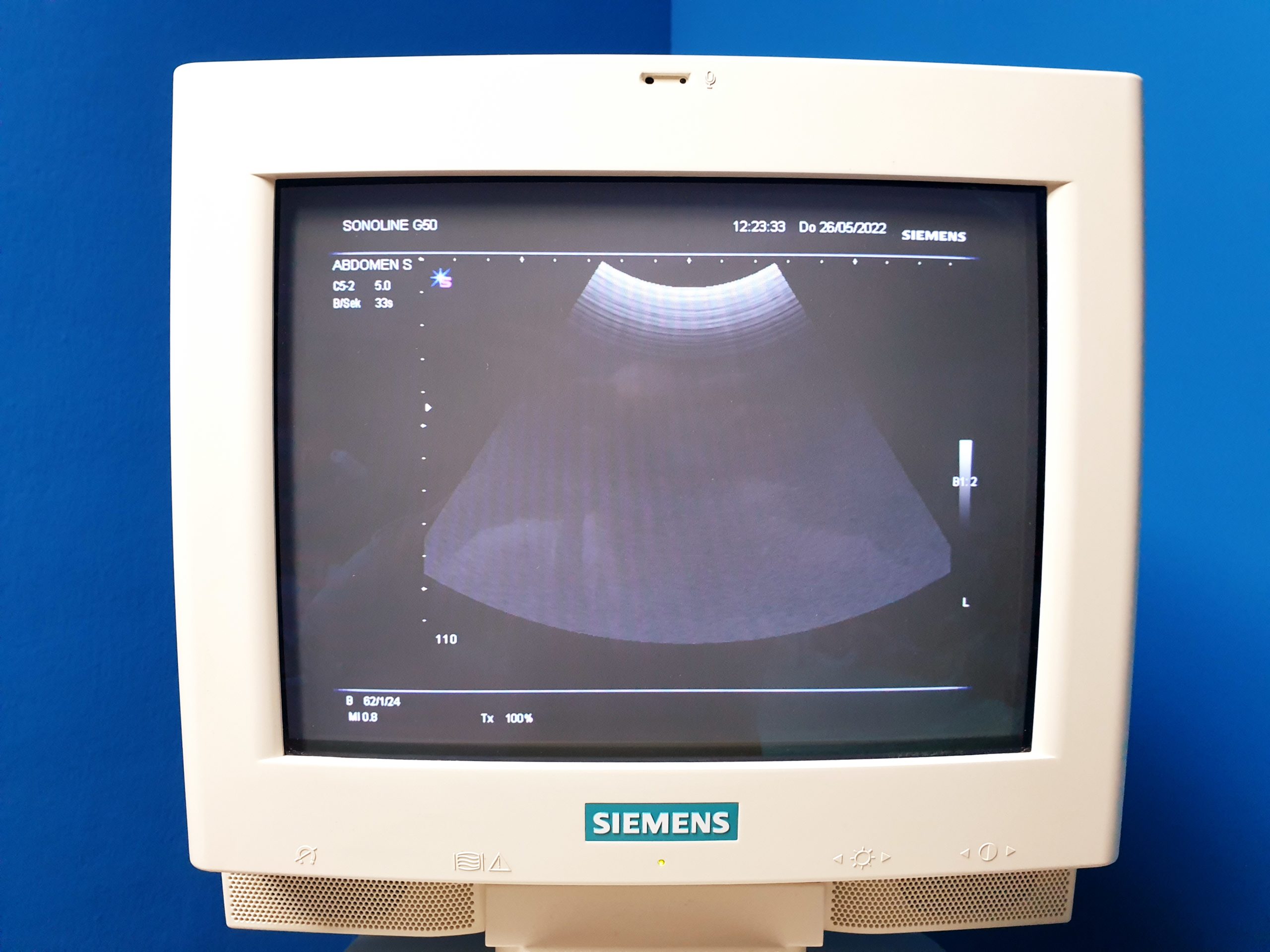 Siemens G50 // G 50 MIT C5-2 Konvex + 7.5L70 Linear + BE09-4 Endovaginal + Printer – Farbdoppler thumbnail 2
