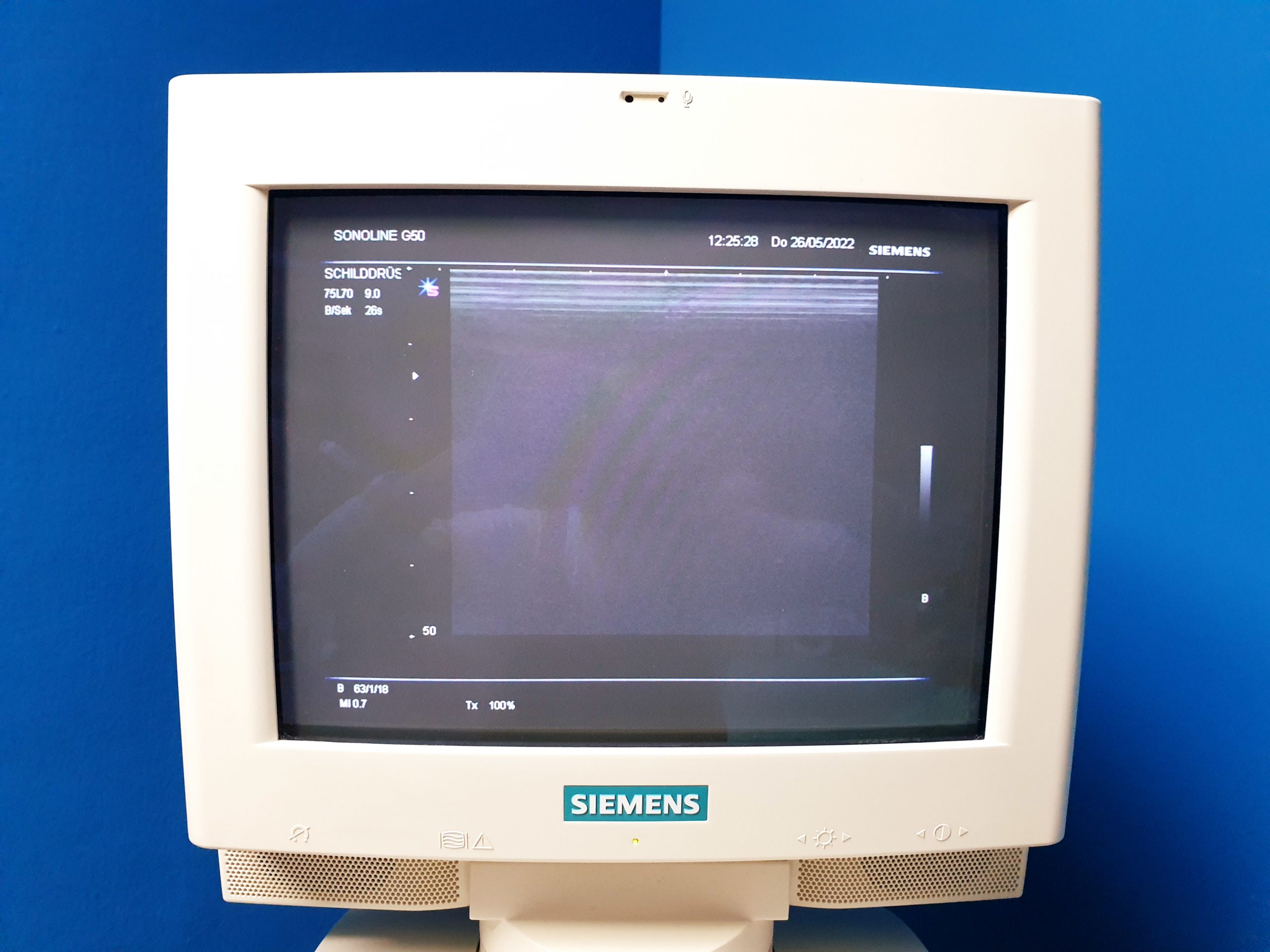 Siemens G50 // G 50 MIT C5-2 Konvex + 7.5L70 Linear + BE09-4 Endovaginal + Printer – Farbdoppler thumbnail 3