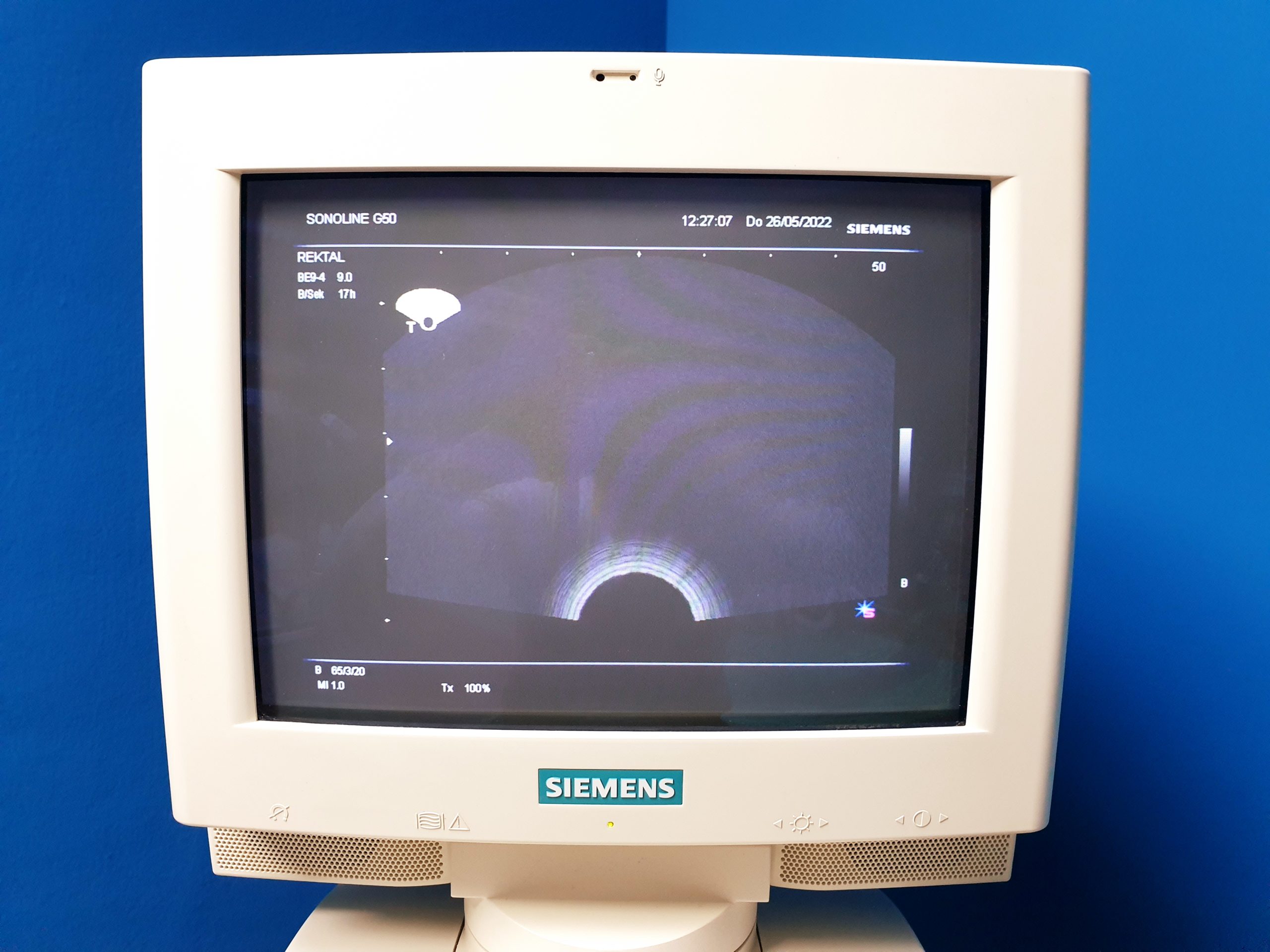 Siemens G50 // G 50 MIT C5-2 Konvex + 7.5L70 Linear + BE09-4 Endovaginal + Printer – Farbdoppler thumbnail 5