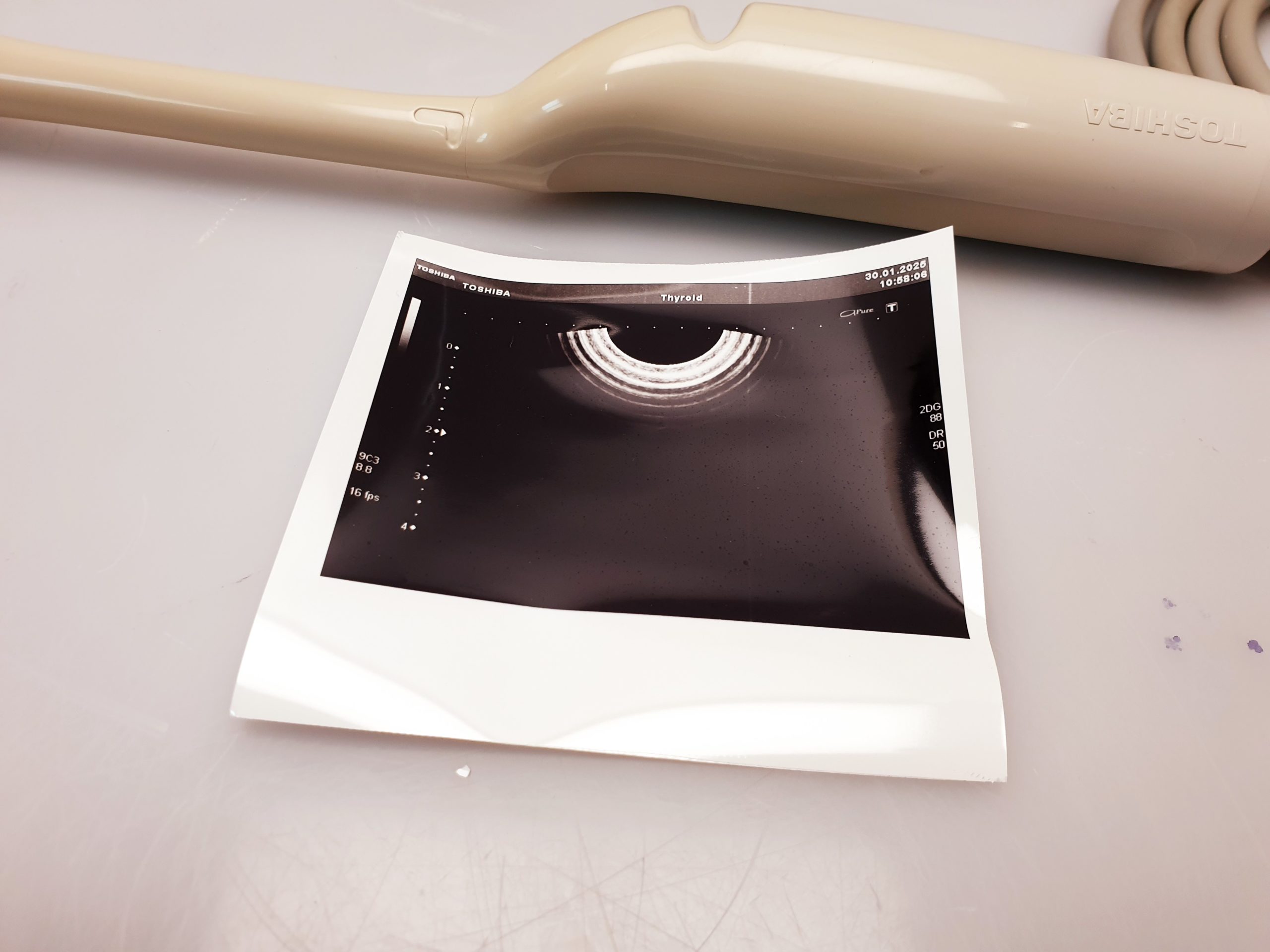 Toshiba 9C3 – PVT-661VT – Endovaginale thumbnail 3