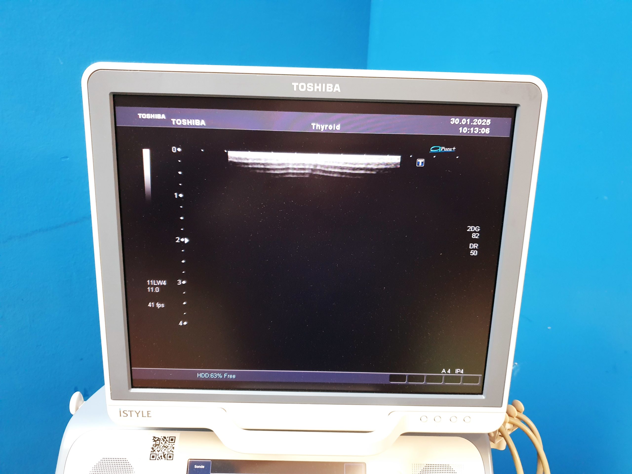 Toshiba SSA-680A Xario XG Farbdoppler PVT-375BT + PLT-805AT + PLT-704SBT thumbnail 8