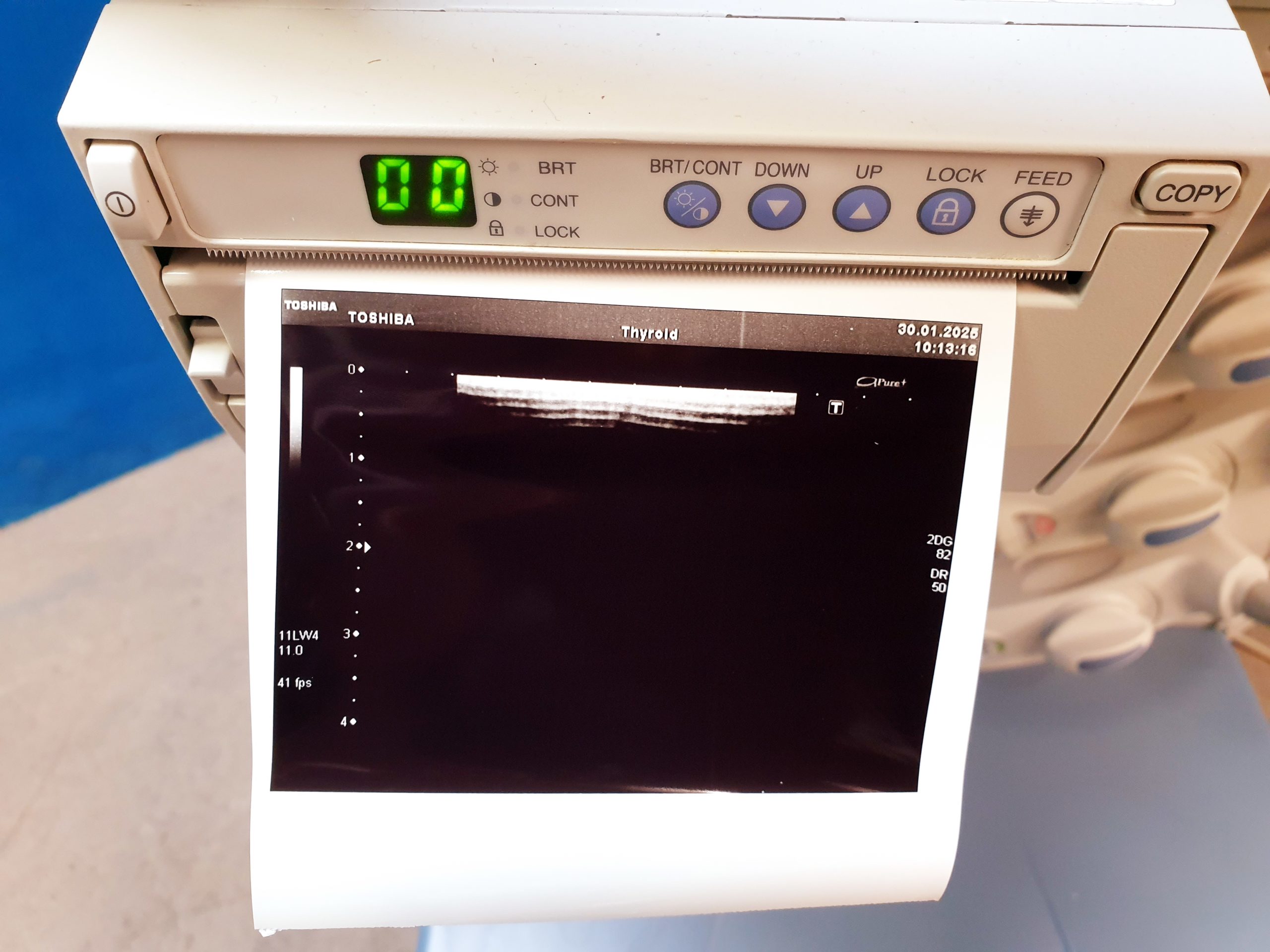 Toshiba SSA-680A Xario XG Farbdoppler PVT-375BT + PLT-805AT + PLT-704SBT thumbnail 9