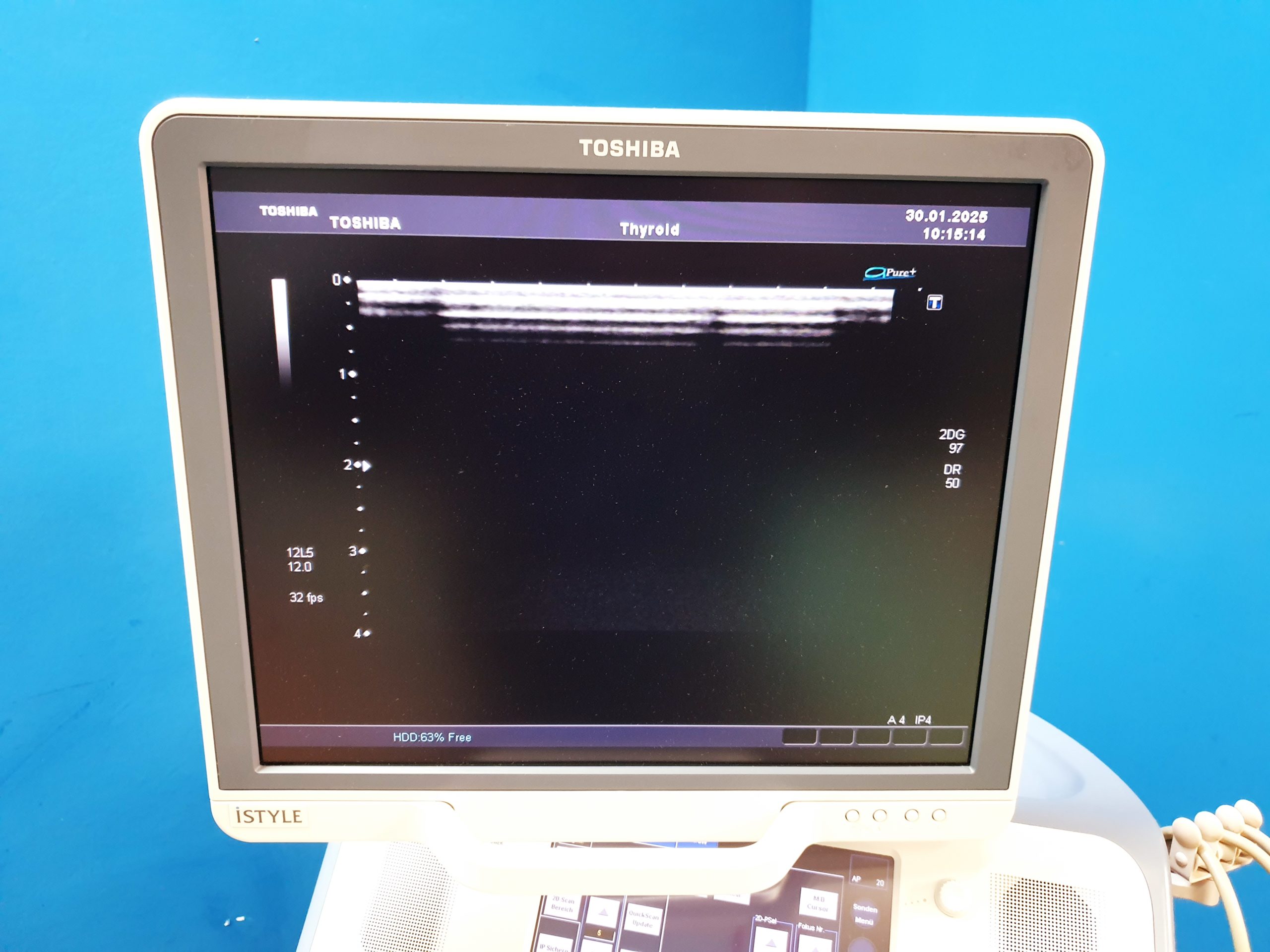 Toshiba SSA-680A Xario XG Farbdoppler PVT-375BT + PLT-805AT + PLT-704SBT thumbnail 12