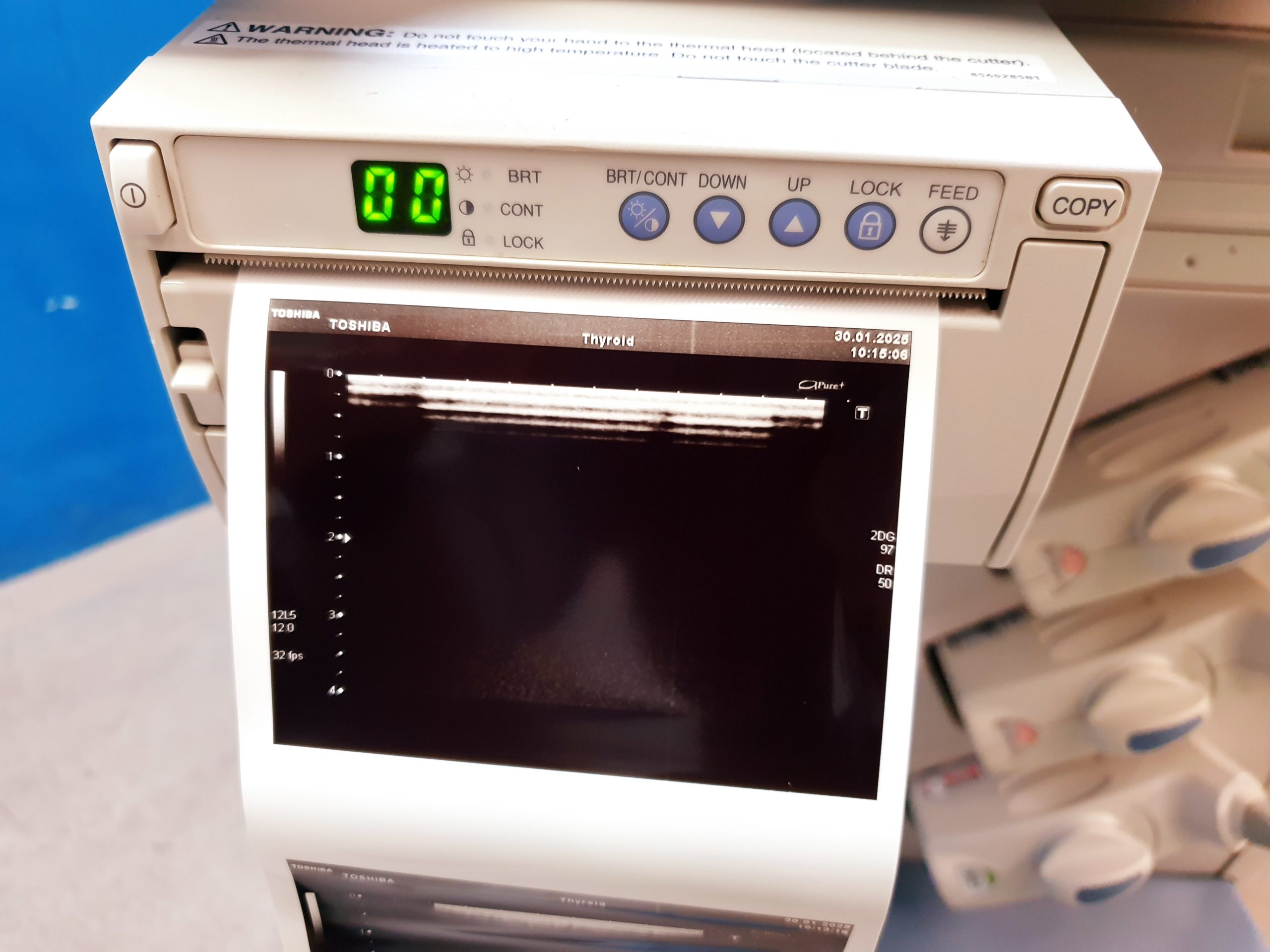 Toshiba SSA-680A Xario XG Farbdoppler PVT-375BT + PLT-805AT + PLT-704SBT thumbnail 13