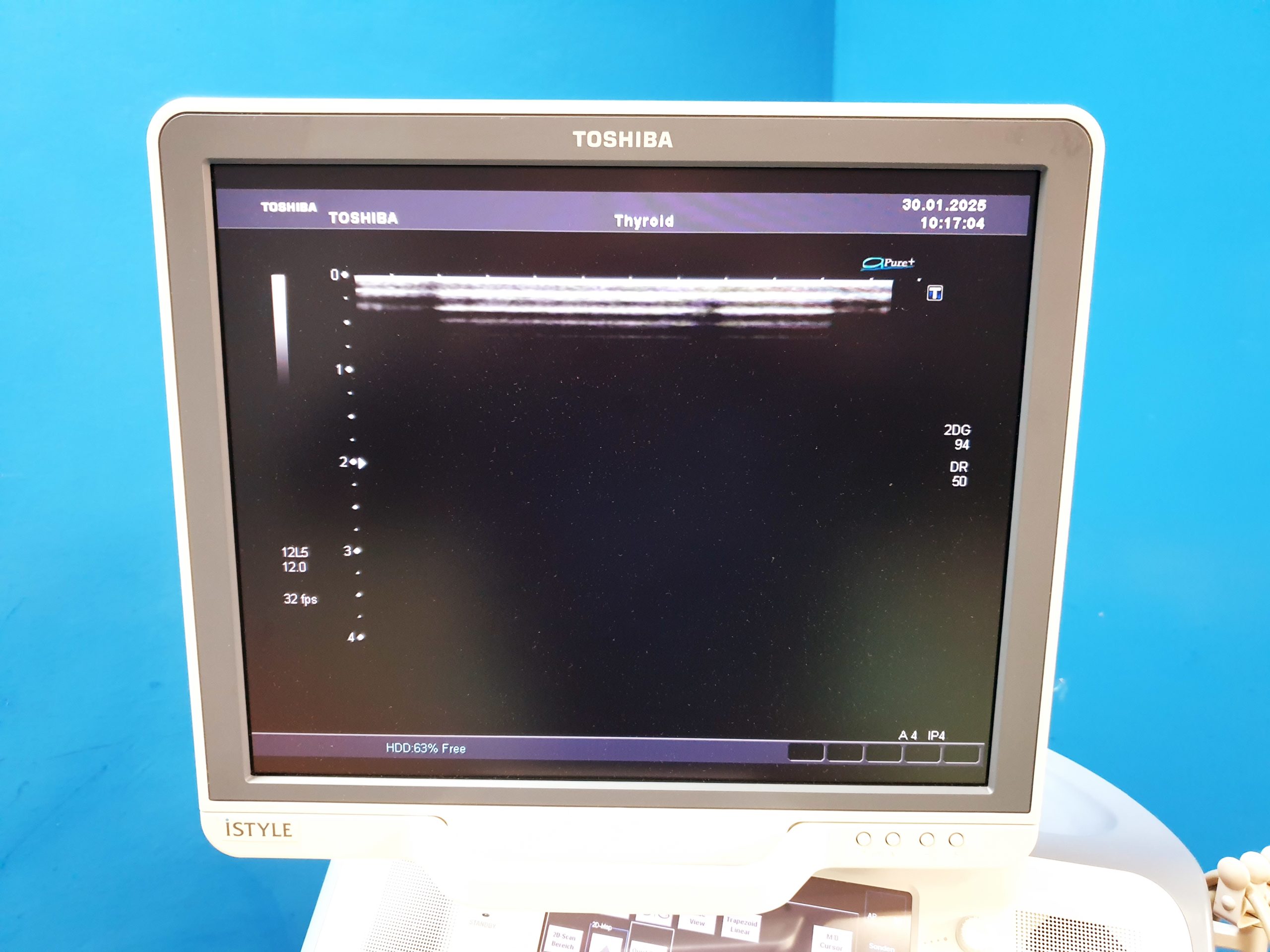Toshiba SSA-680A Xario XG Farbdoppler PVT-375BT + PLT-805AT + PLT-704SBT thumbnail 15