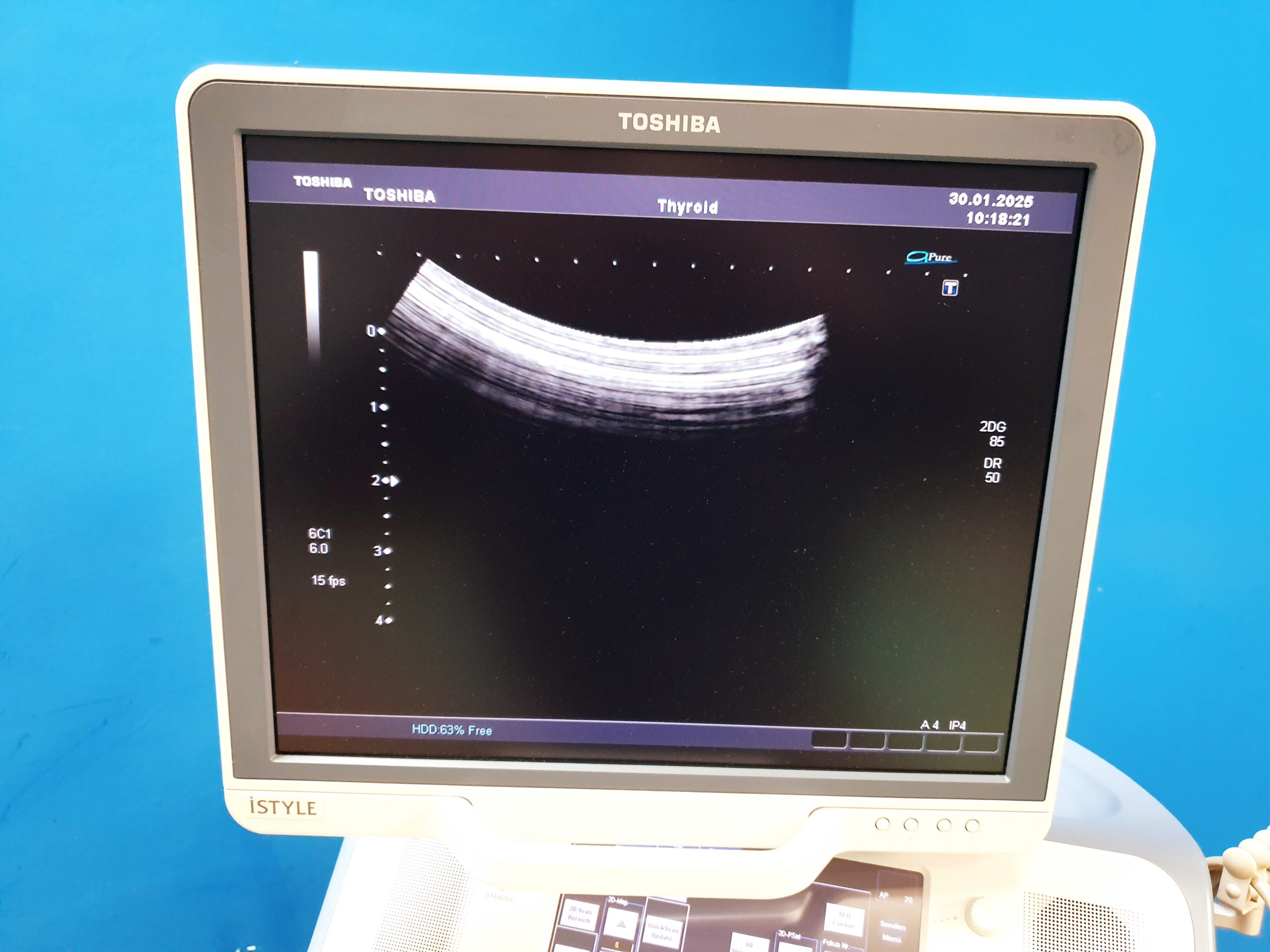 Toshiba SSA-680A Xario XG Farbdoppler PVT-375BT + PLT-805AT + PLT-704SBT thumbnail 18