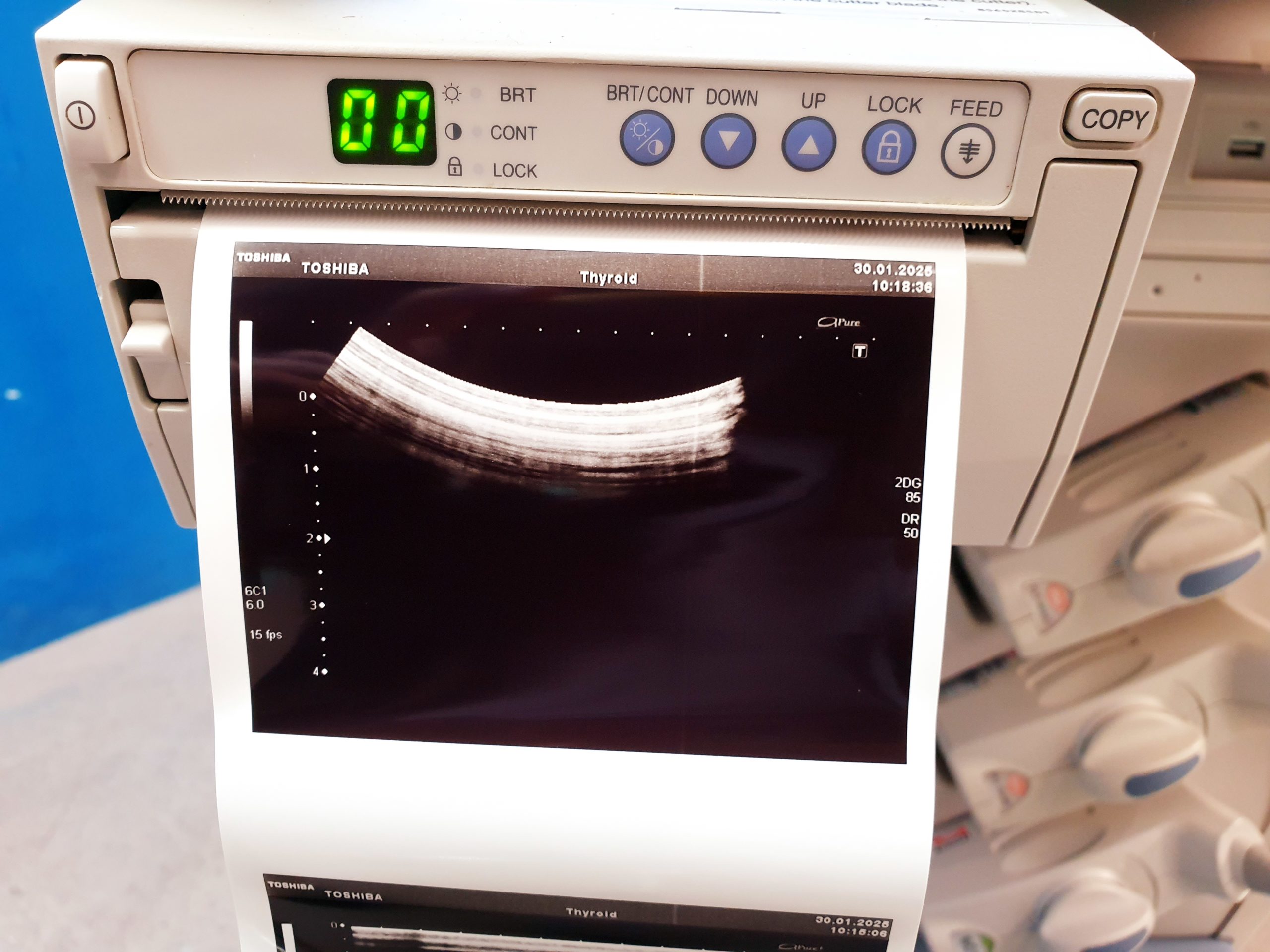 Toshiba SSA-680A Xario XG Farbdoppler PVT-375BT + PLT-805AT + PLT-704SBT thumbnail 19