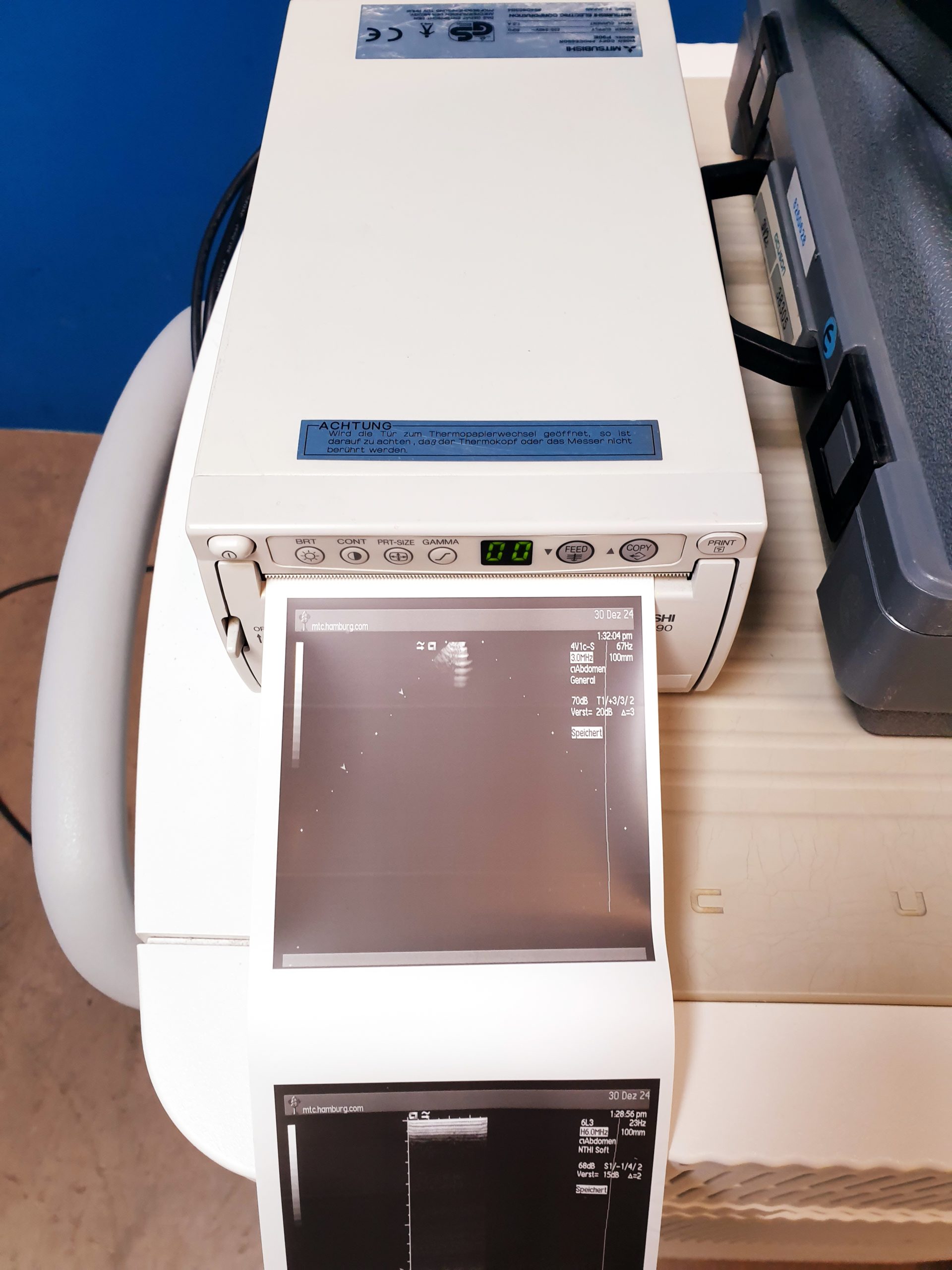 Siemens Acuson Sequoia 512 Farbdoppler + 4V1c + 4C1 + 6L3 thumbnail 12