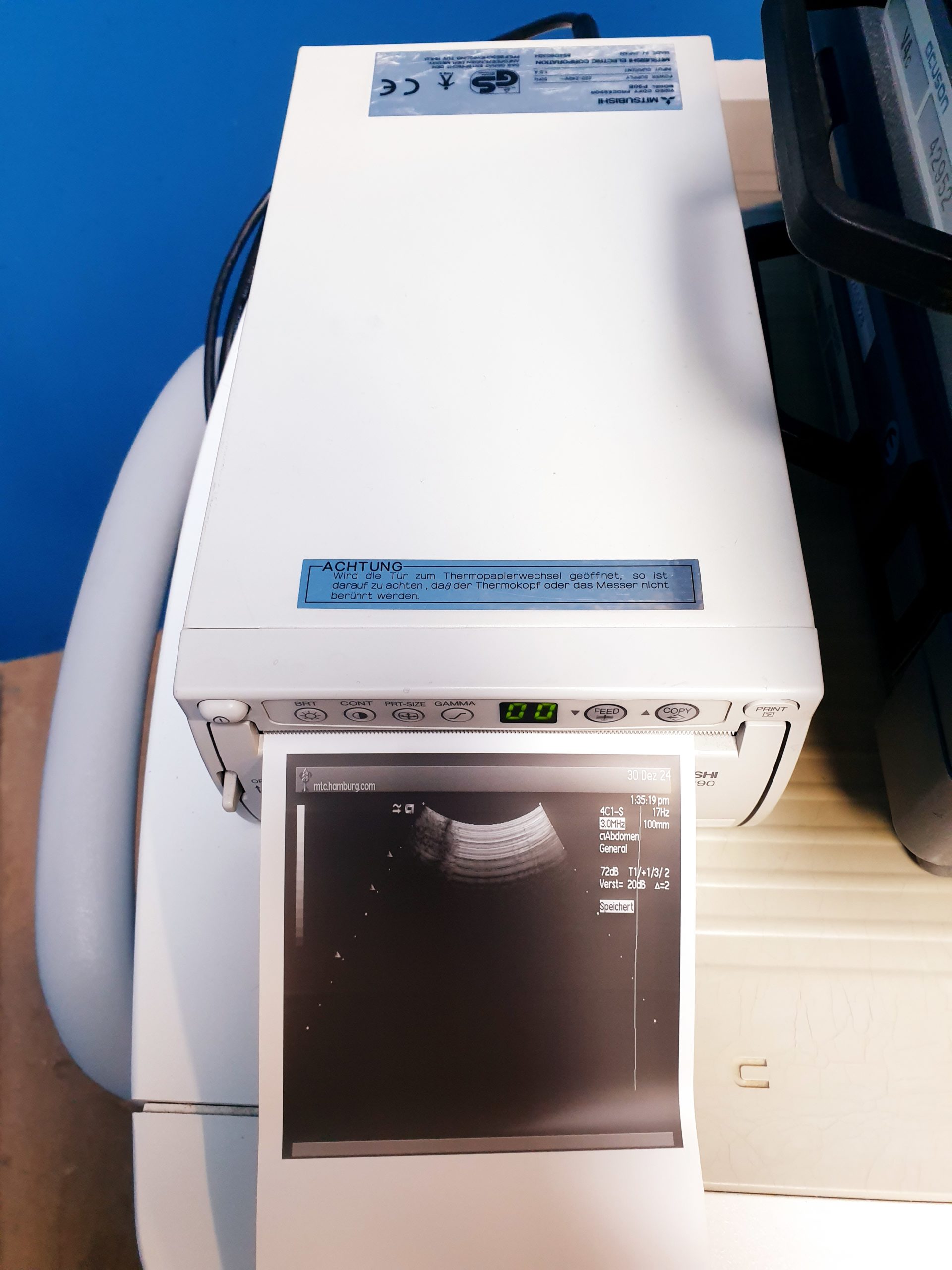 Siemens Acuson Sequoia 512 Farbdoppler + 4V1c + 4C1 + 6L3 thumbnail 19