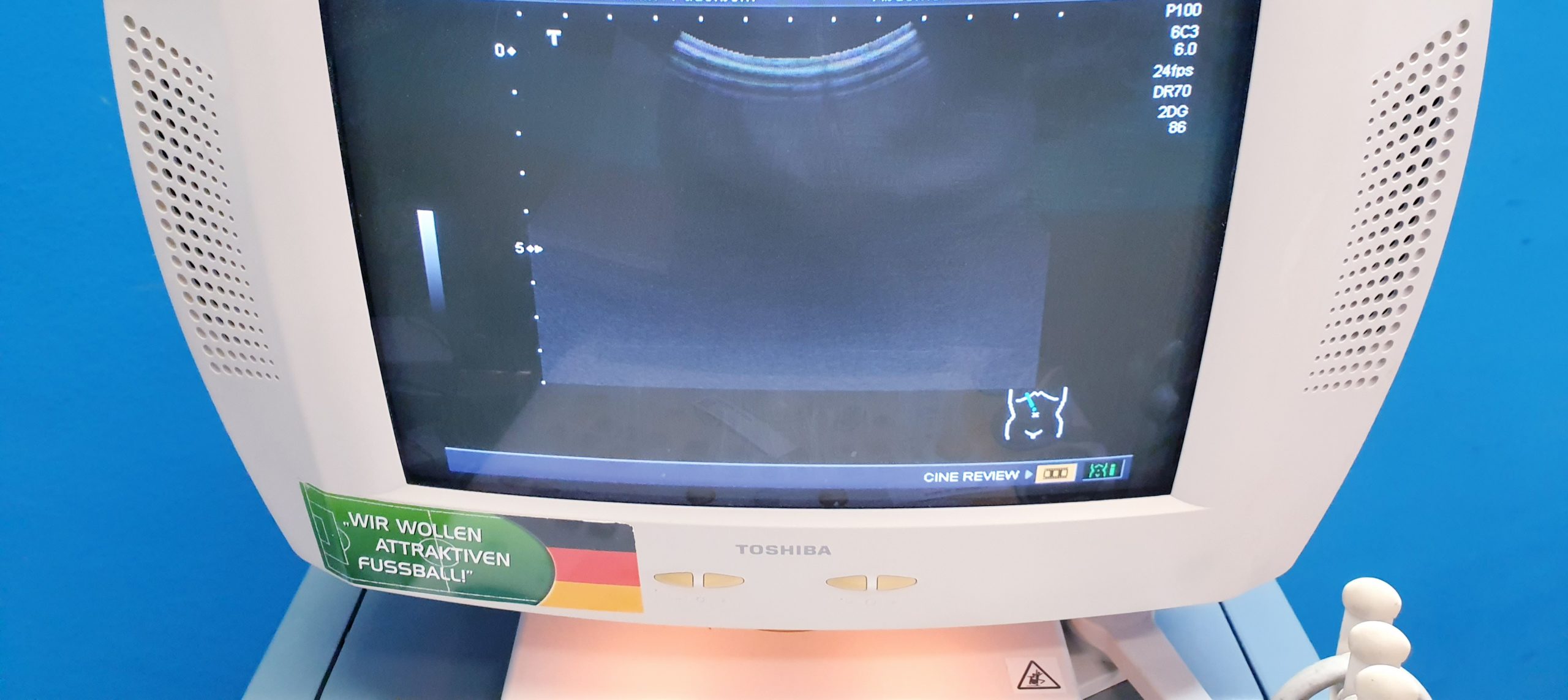Toshiba PVM-375AT Konvex Ultrasound Transducer thumbnail 2