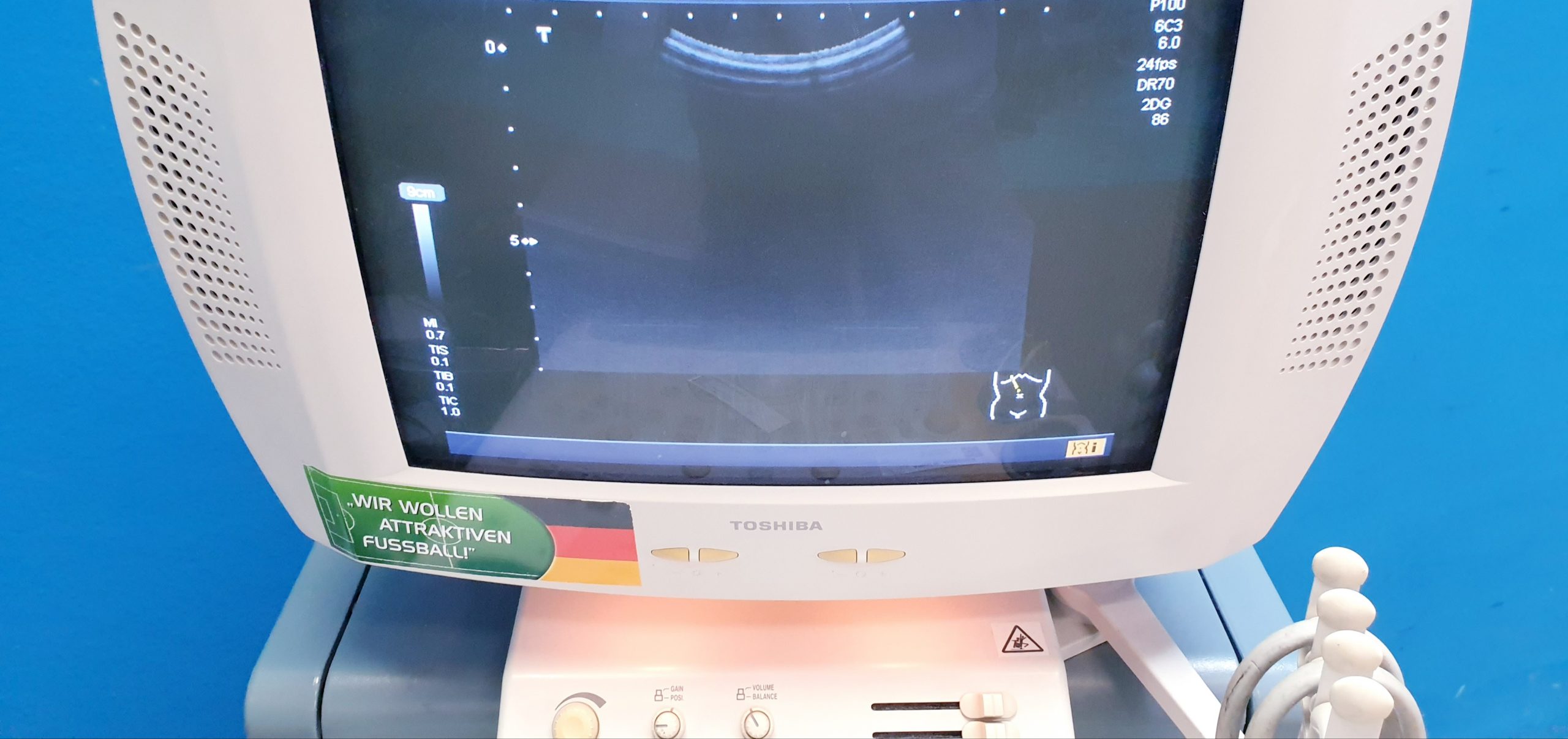 Toshiba PVM-375AT Konvex Ultrasound Transducer thumbnail 10