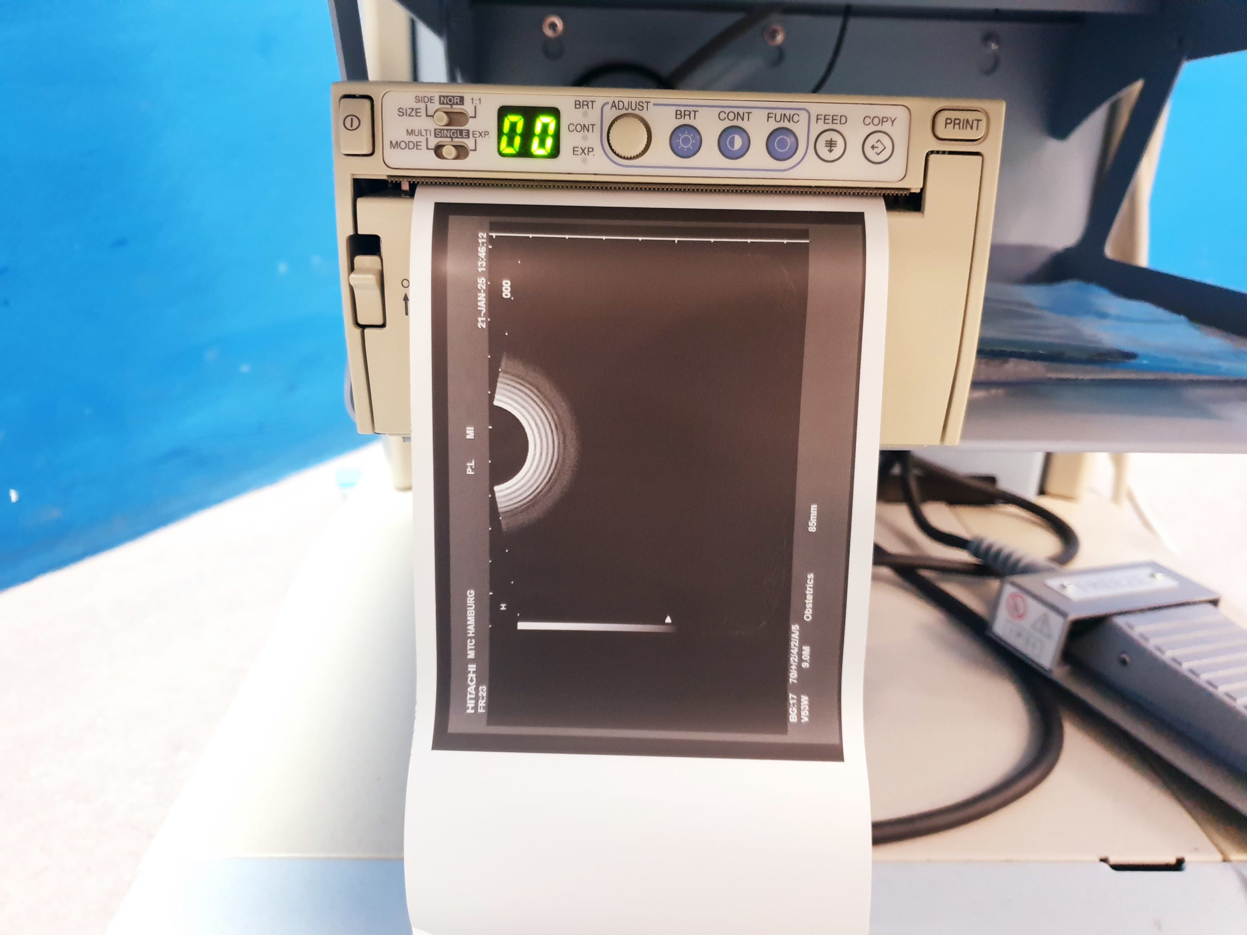 Hitachi EUP-V53w Vaginal Sonde thumbnail 2
