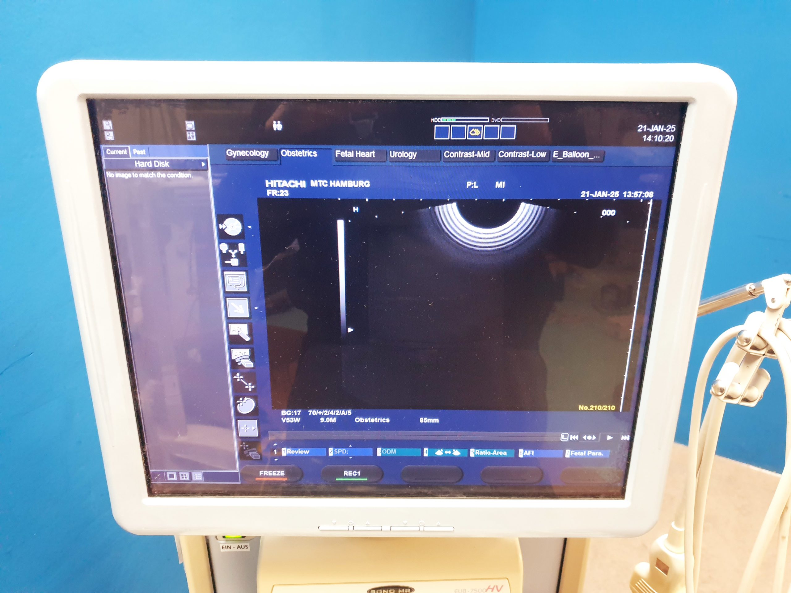 Hitachi EUP-V53w Vaginal Sonde thumbnail 3