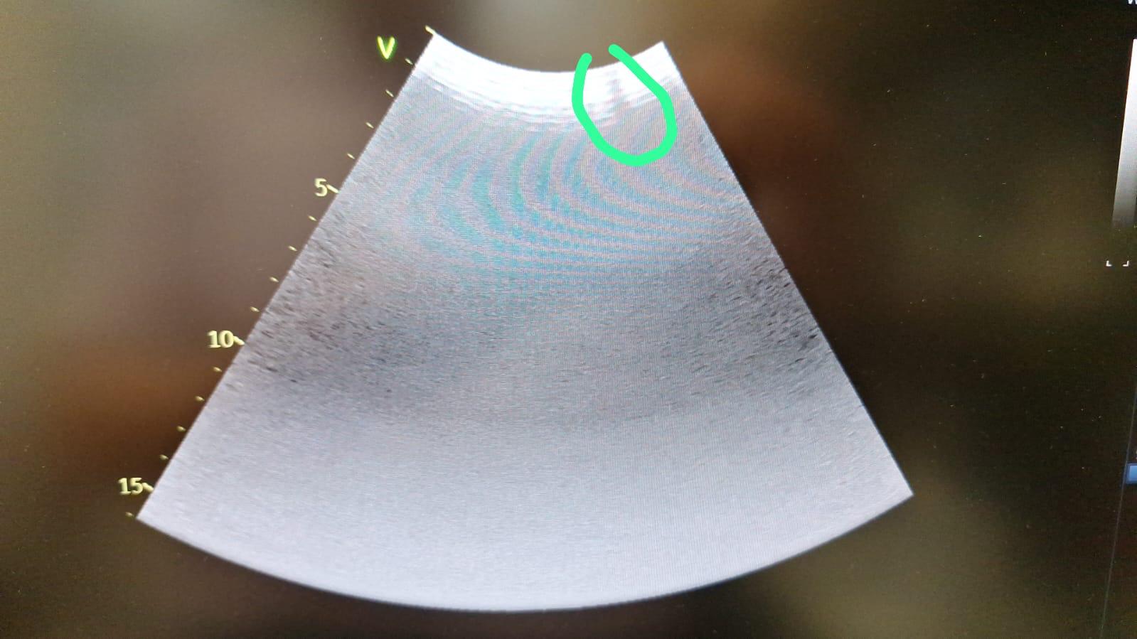 GE C1-6-D Ultraschallsonde Convex Sonde – DOM 2020 – DEFEKT thumbnail 2
