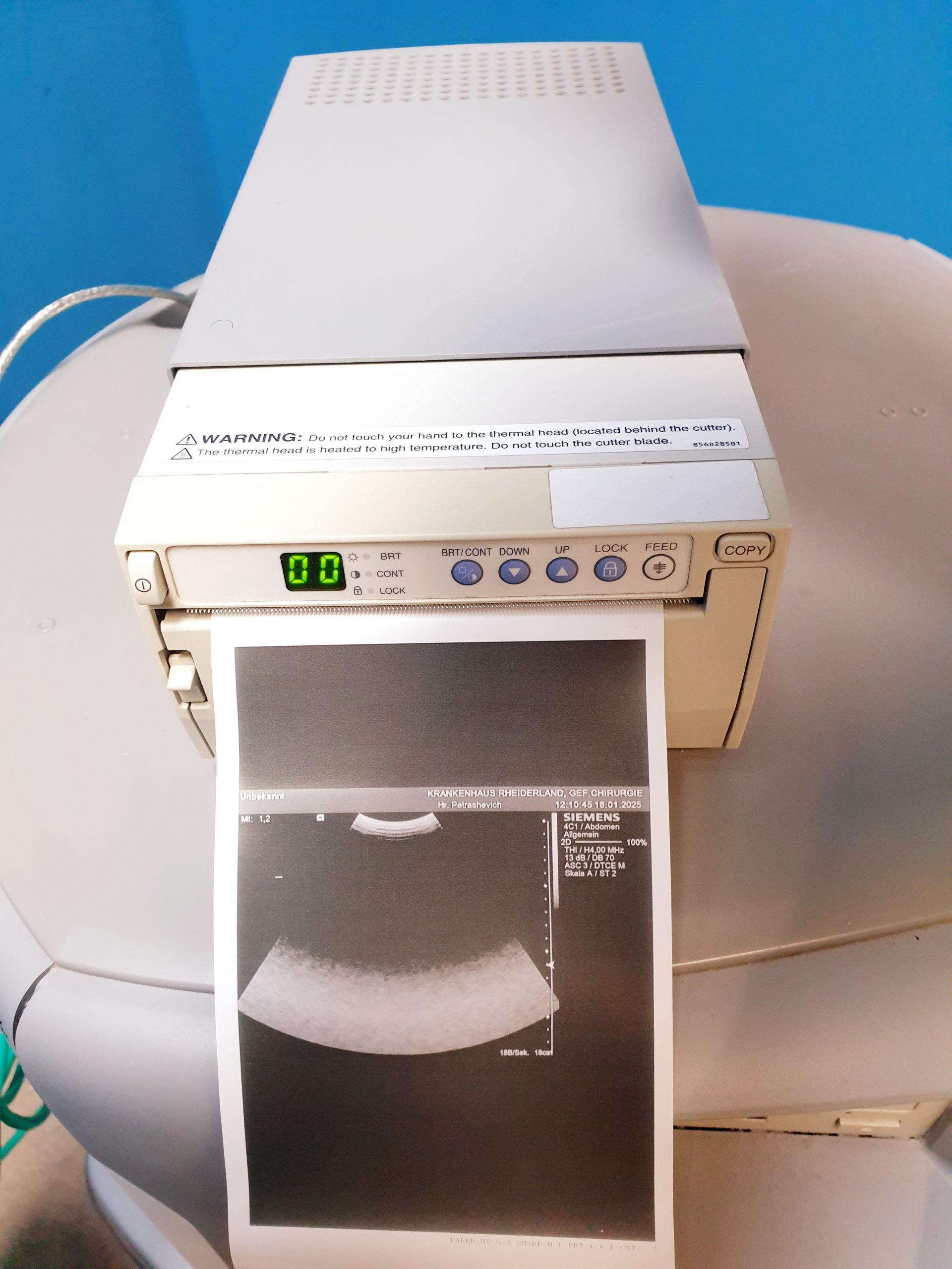 Siemens Acuson S2000 Baujahr 2011 mit drei Sonden Acuson 9L4, Acuson 4V1c, Acuson 4C1, thumbnail 9