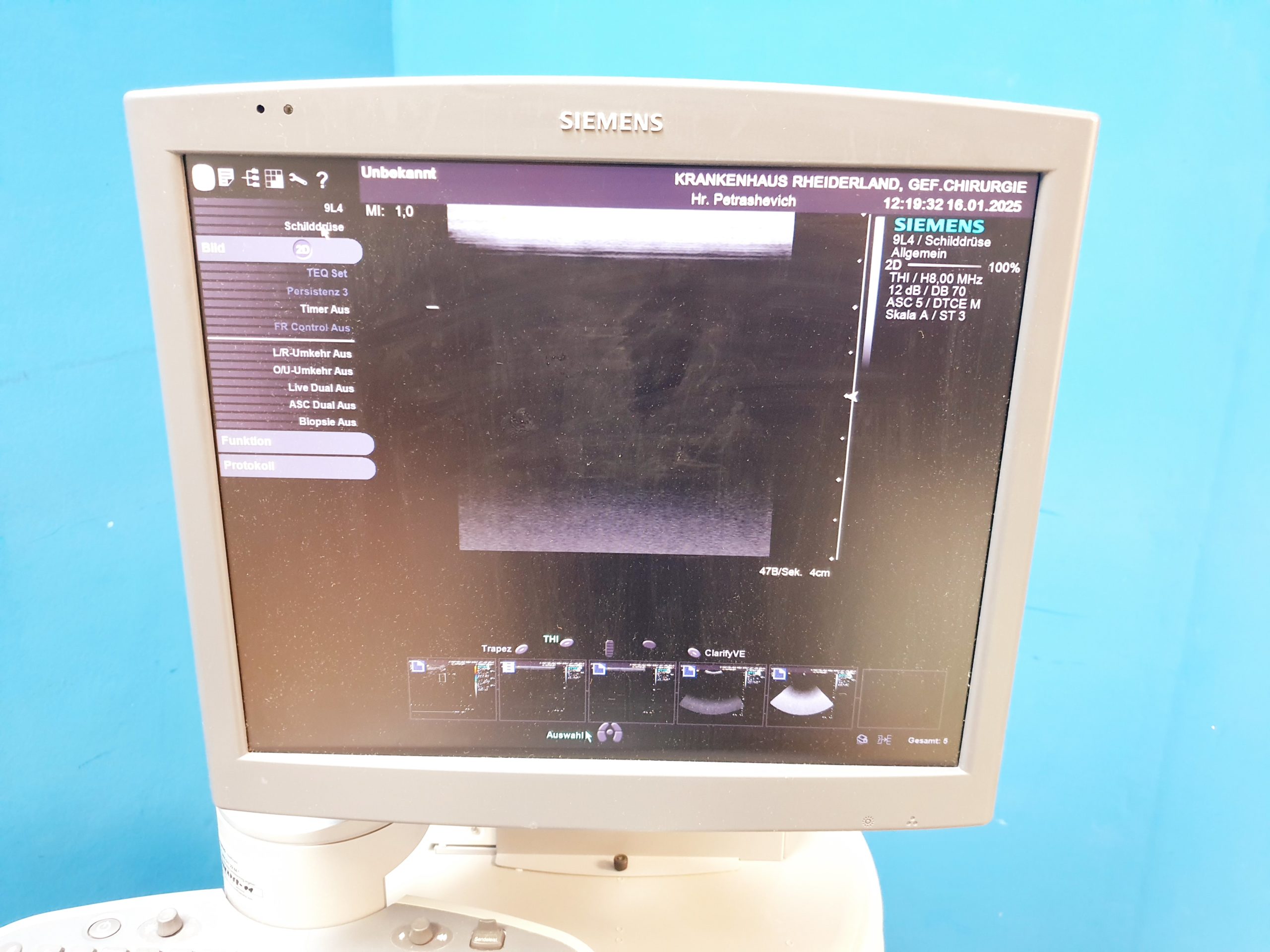 Siemens Acuson S2000 Baujahr 2011 mit drei Sonden Acuson 9L4, Acuson 4V1c, Acuson 4C1, thumbnail 18