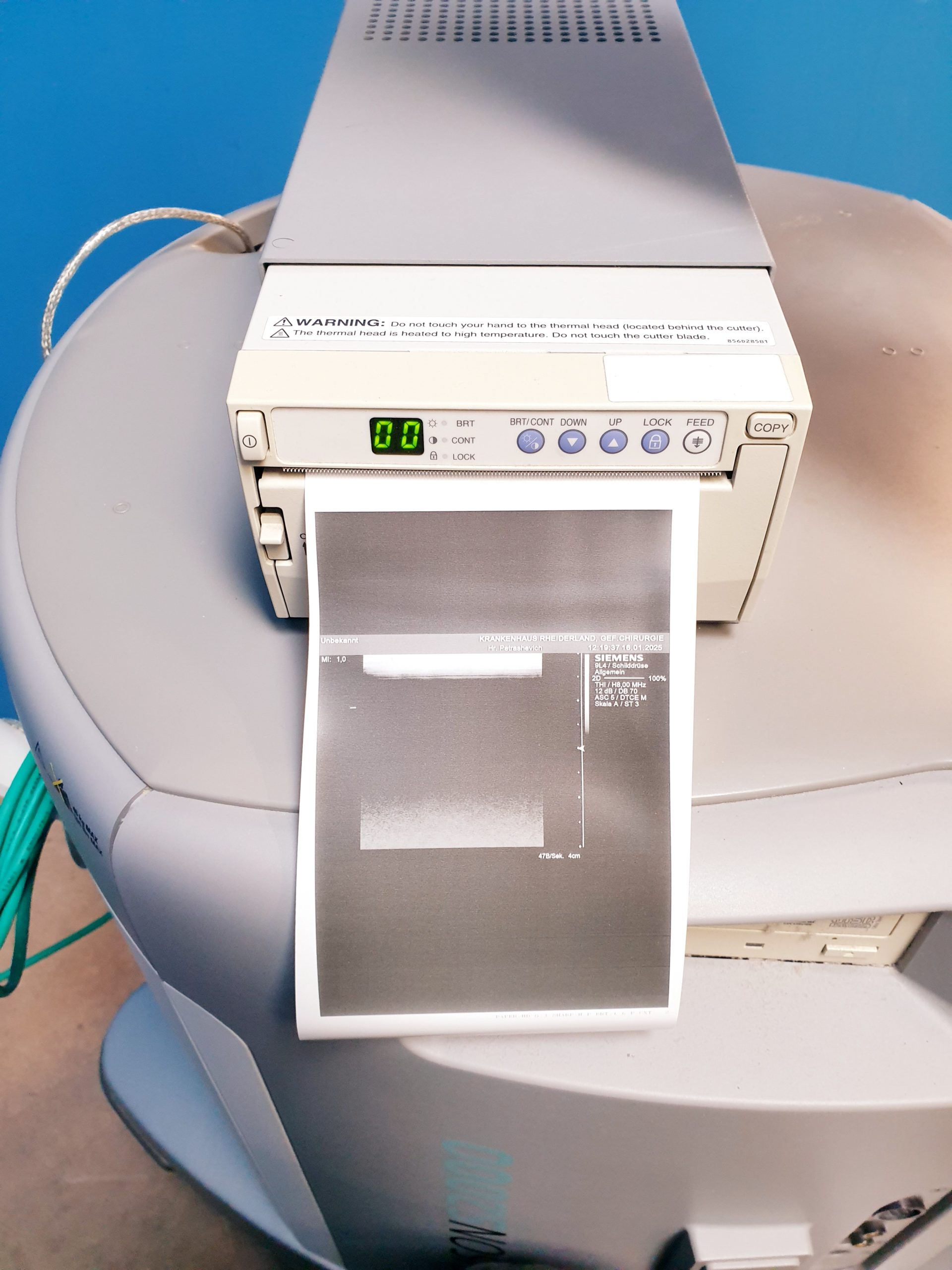 Siemens Acuson S2000 Baujahr 2011 mit drei Sonden Acuson 9L4, Acuson 4V1c, Acuson 4C1, thumbnail 19