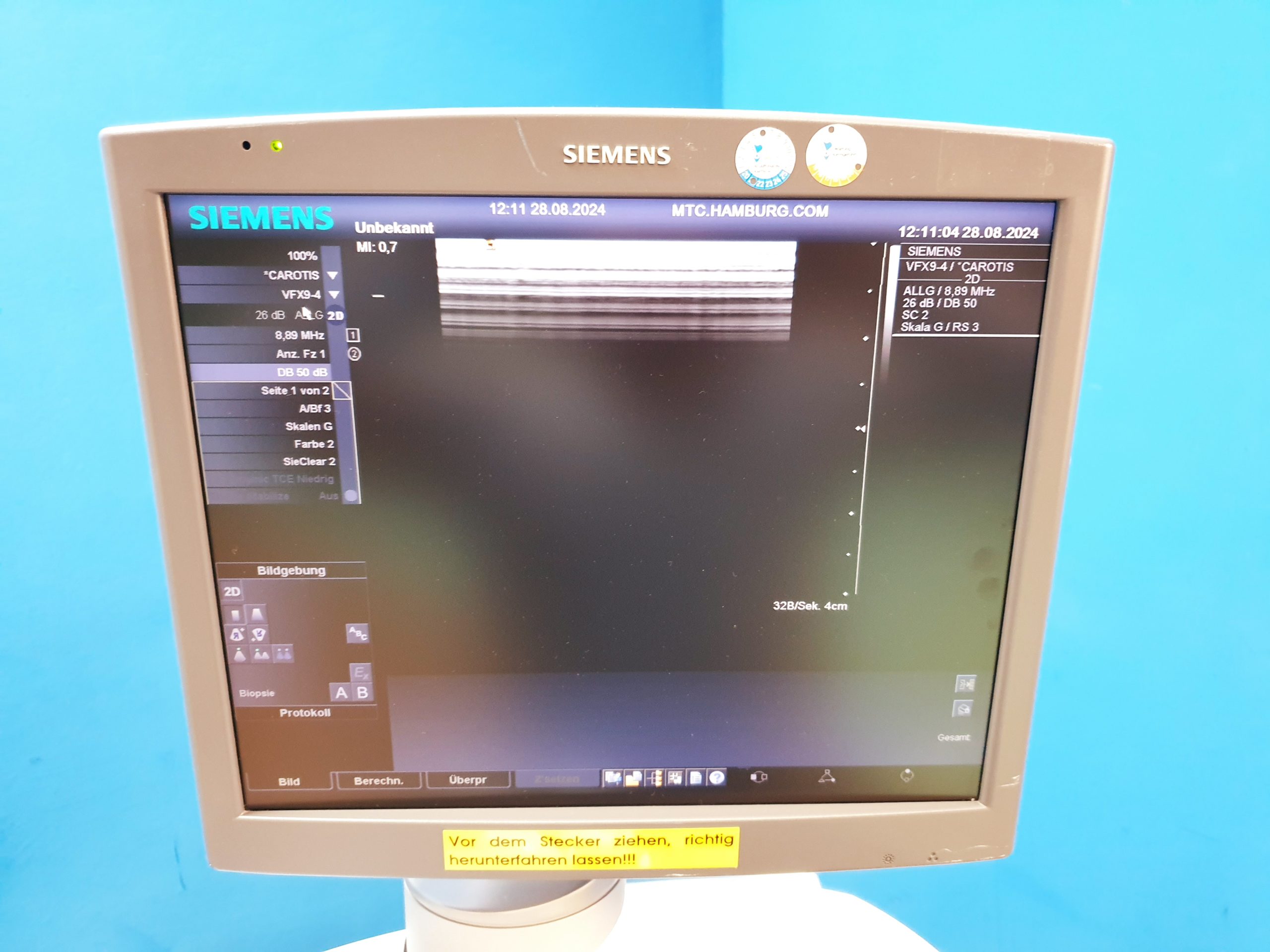 Siemens Acuson Antares Fahrdoppler Doppler + VFX9-4 + PH4-1 Kardio DOM 2011 thumbnail 8