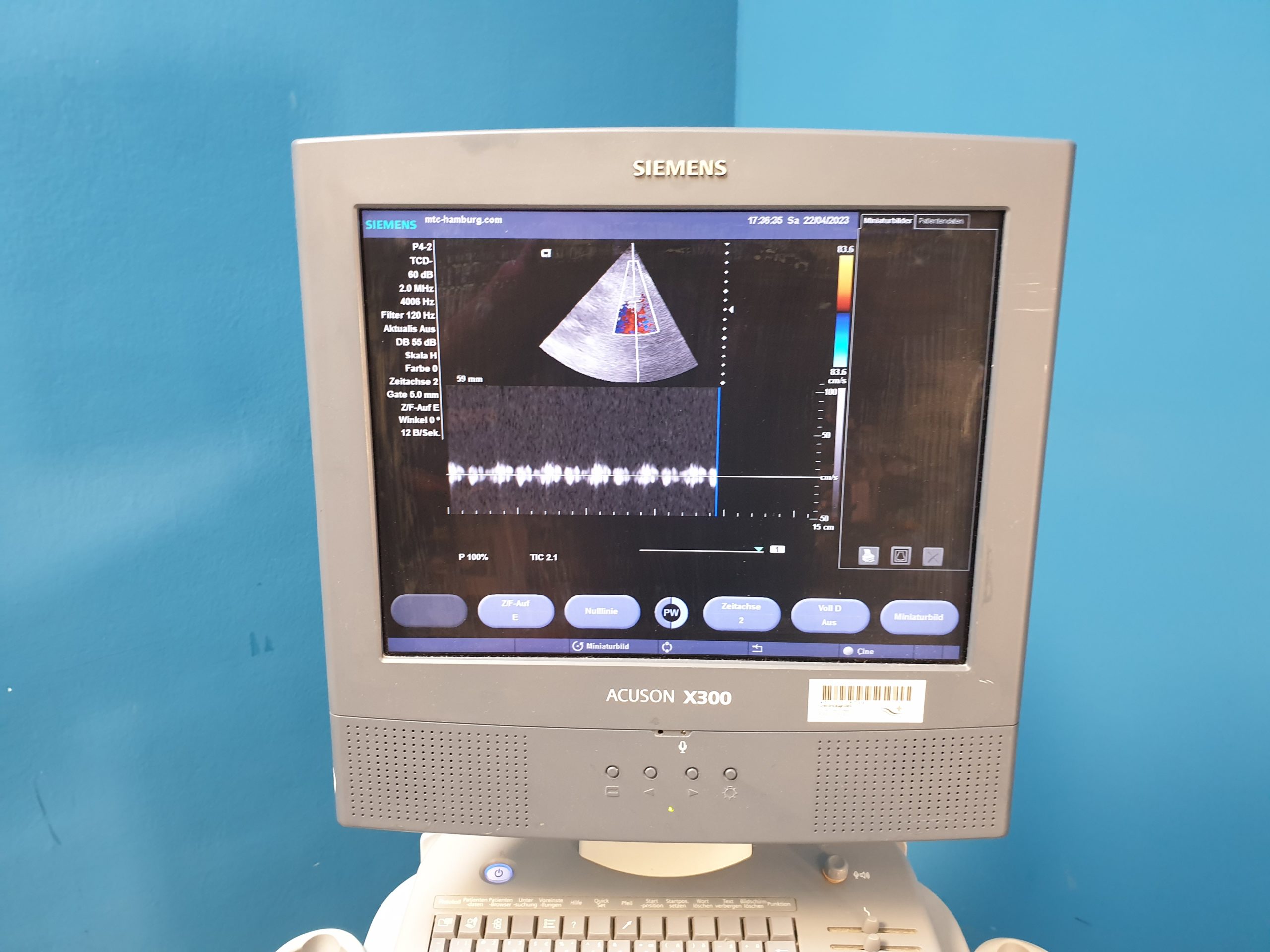 SIEMENS Acuson X300 // X 300 , CH5-2+ VF8 + 3 P4-2 Doppler , … thumbnail 2