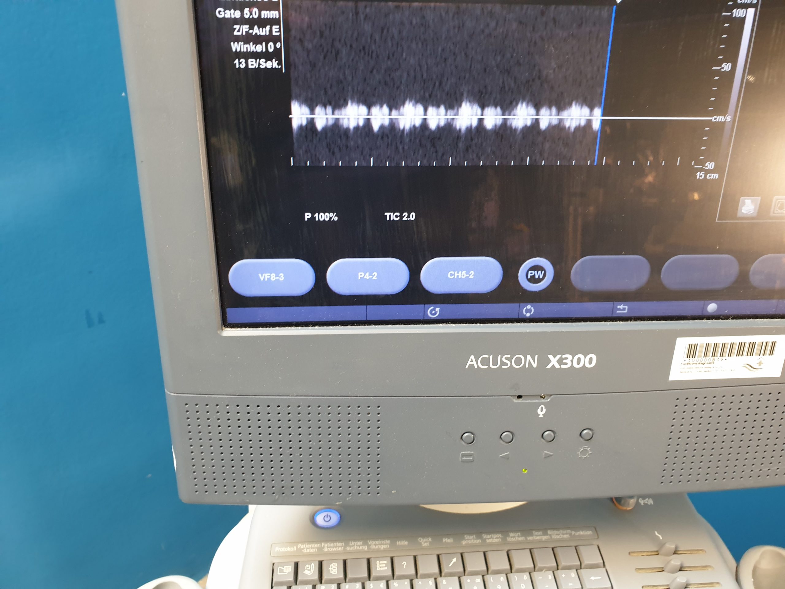 SIEMENS Acuson X300 // X 300 , CH5-2+ VF8 + 3 P4-2 Doppler , … thumbnail 3
