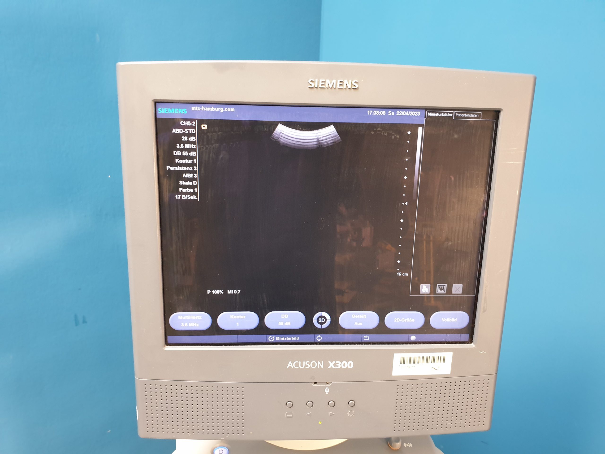 SIEMENS Acuson X300 // X 300 , CH5-2+ VF8 + 3 P4-2 Doppler , … thumbnail 7