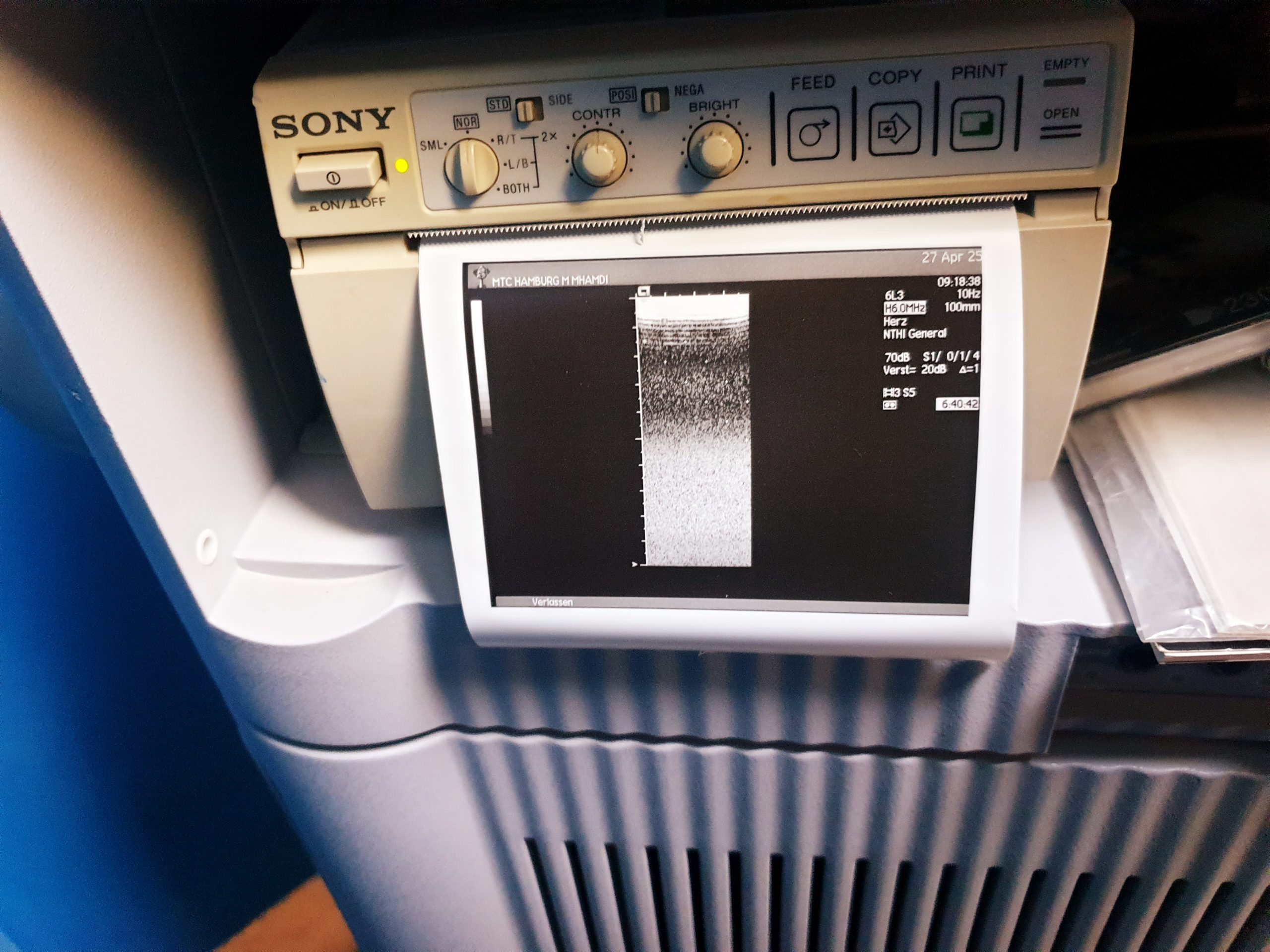Siemens Acuson Sequoia 512 + 4C1 Konvex + 6L3 Linear + 3V2c Echosonde , …. thumbnail 7