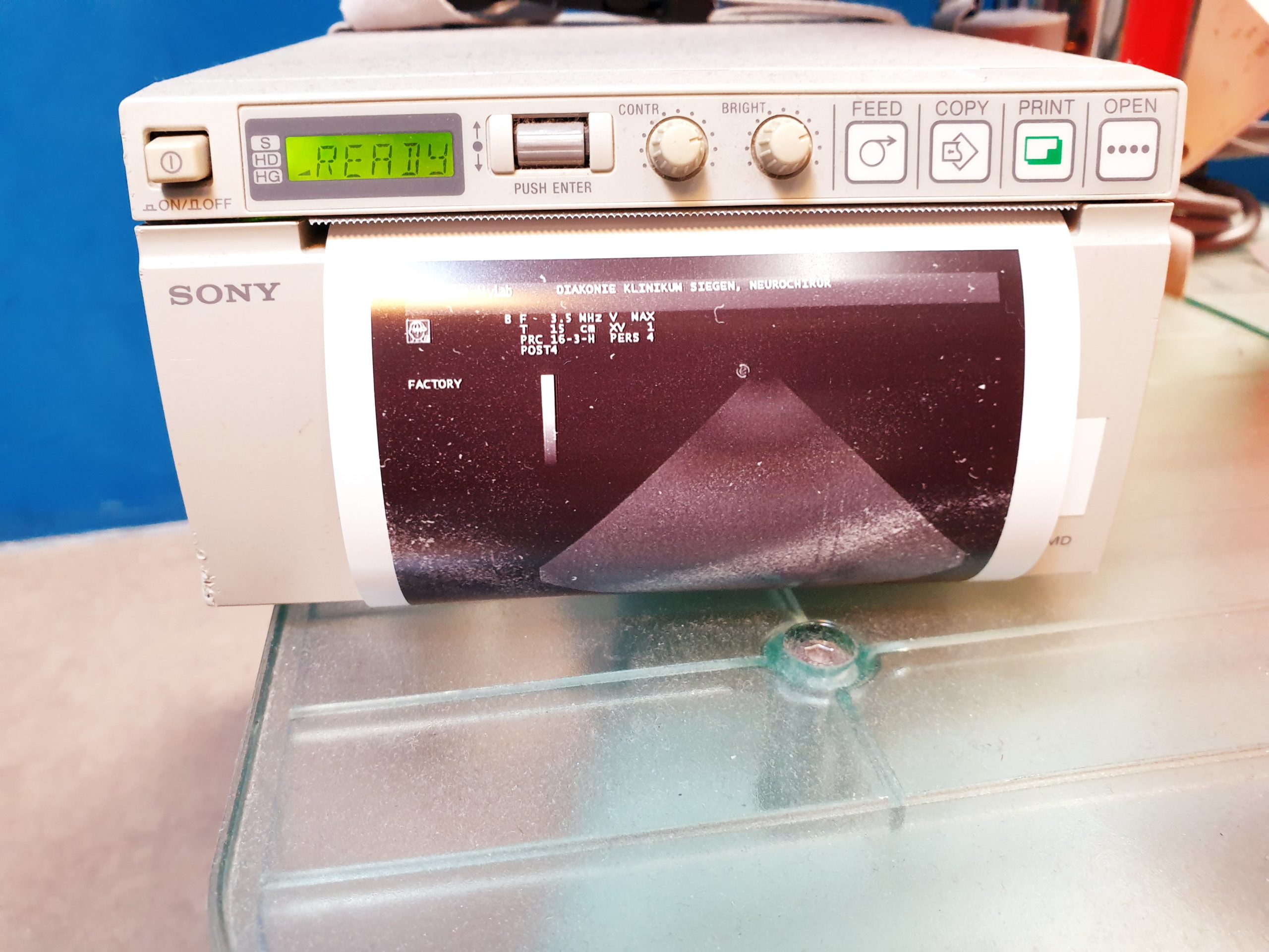 Esaote PA230E Phased Array 1-4 MHz Kardio thumbnail 2