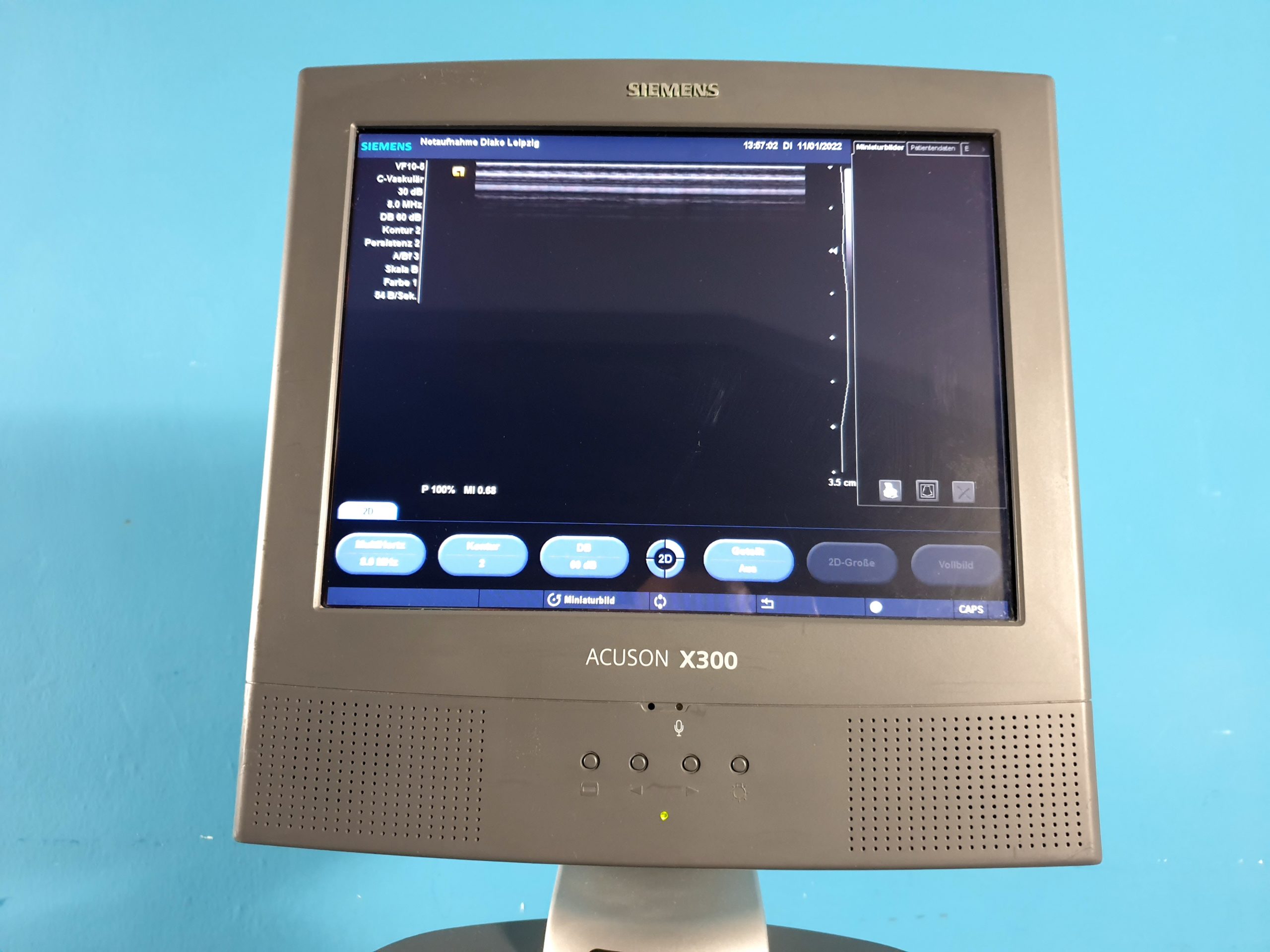 SIEMENS ACUSON X300 X 300 Premium Edition + CH5-2 Konvex + VF10-5 Linear + P93D DOM 2008 thumbnail 9