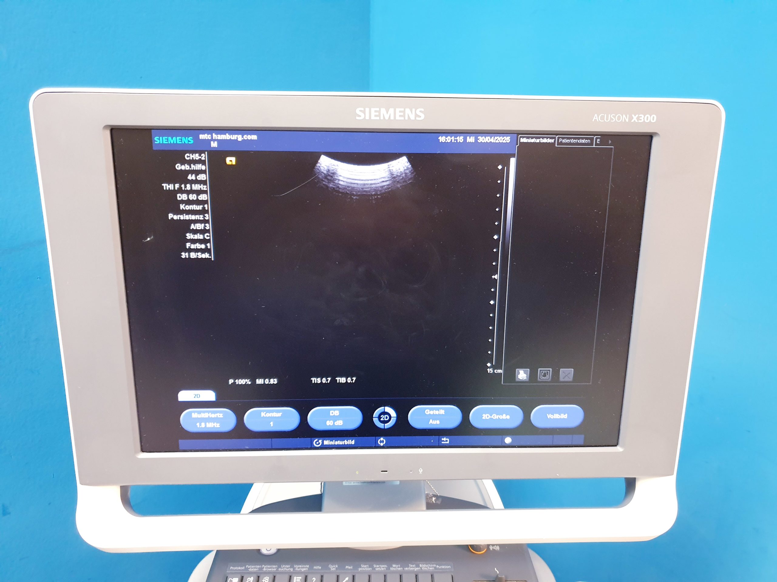 Siemens Acuson X300 X 300 Premium Edition – + CH5-2 Konvex + EC9-4 Endovaginal — thumbnail 7