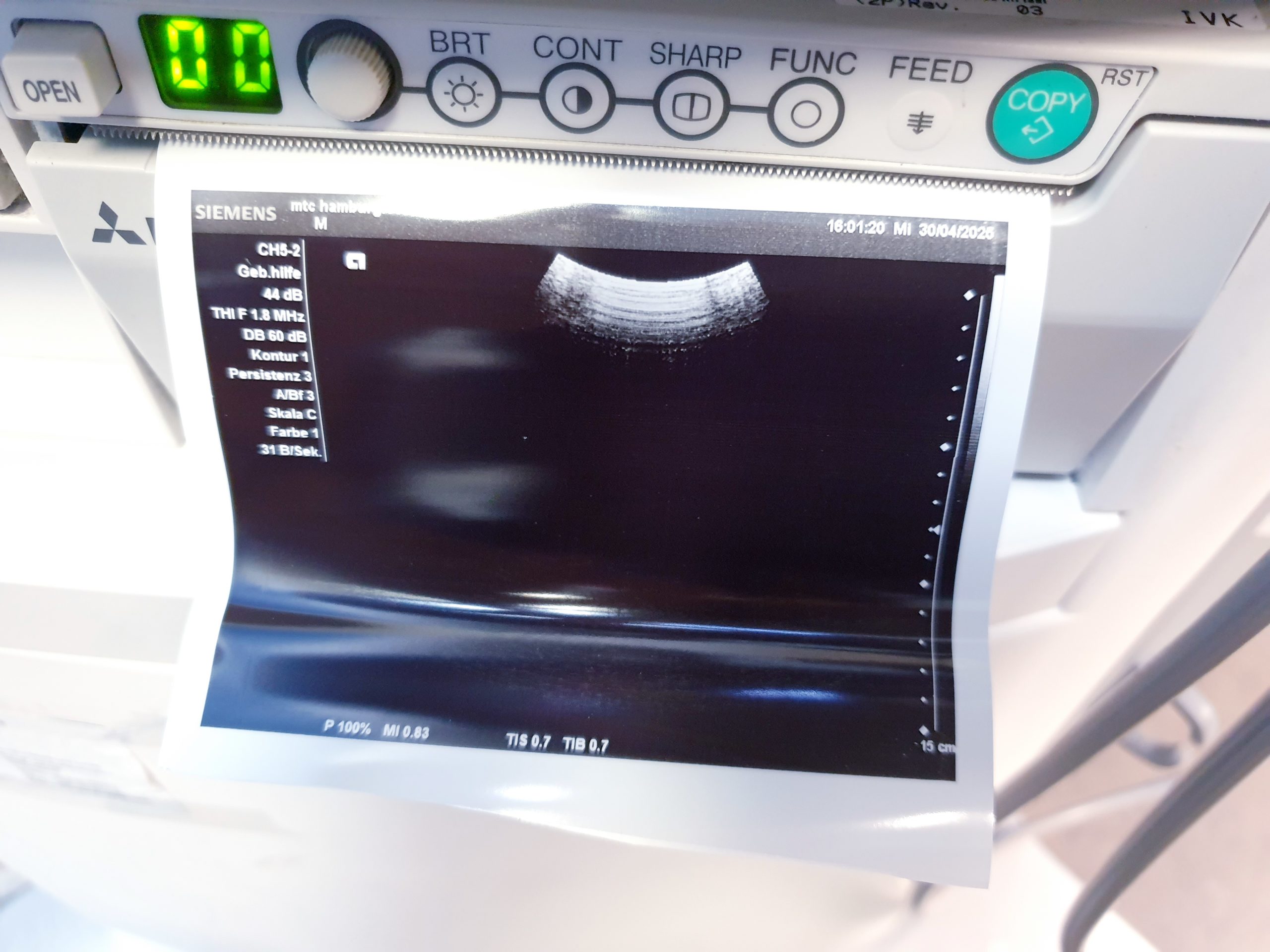 Siemens Acuson X300 X 300 Premium Edition – + CH5-2 Konvex + EC9-4 Endovaginal — thumbnail 8