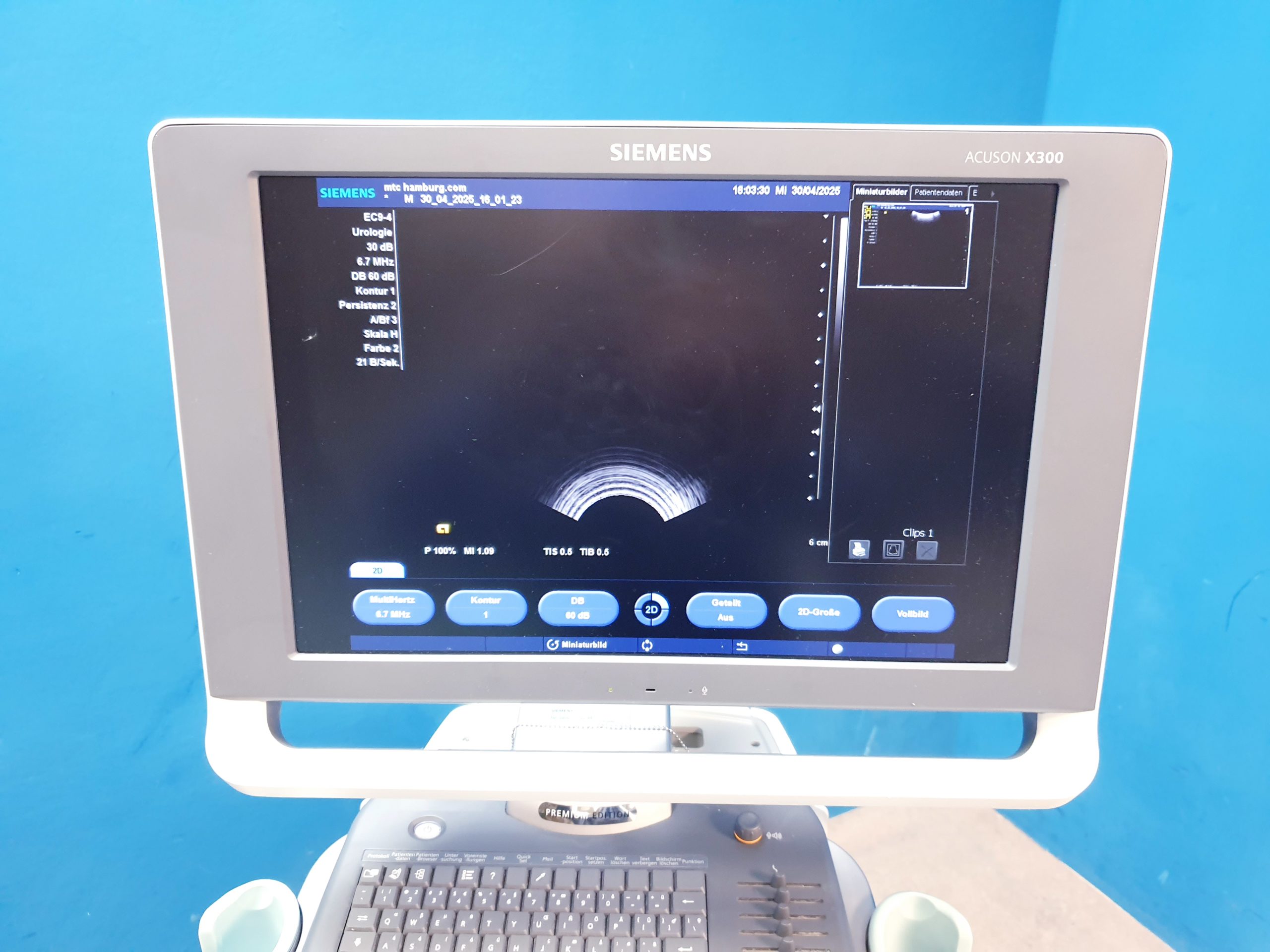 Siemens Acuson X300 X 300 Premium Edition – + CH5-2 Konvex + EC9-4 Endovaginal — thumbnail 14