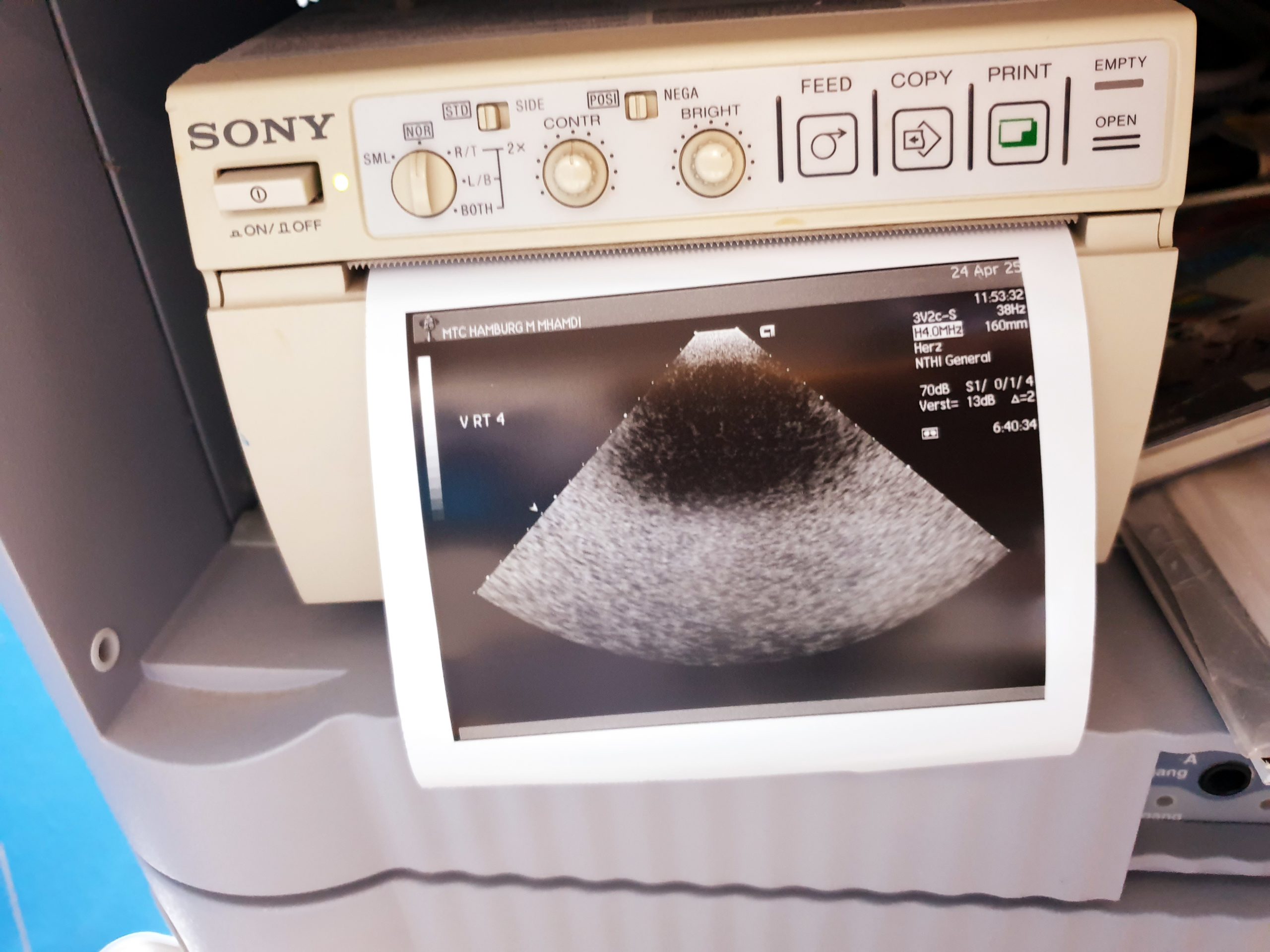Acuson Siemens 3V2c Sonde Echosonde thumbnail 11