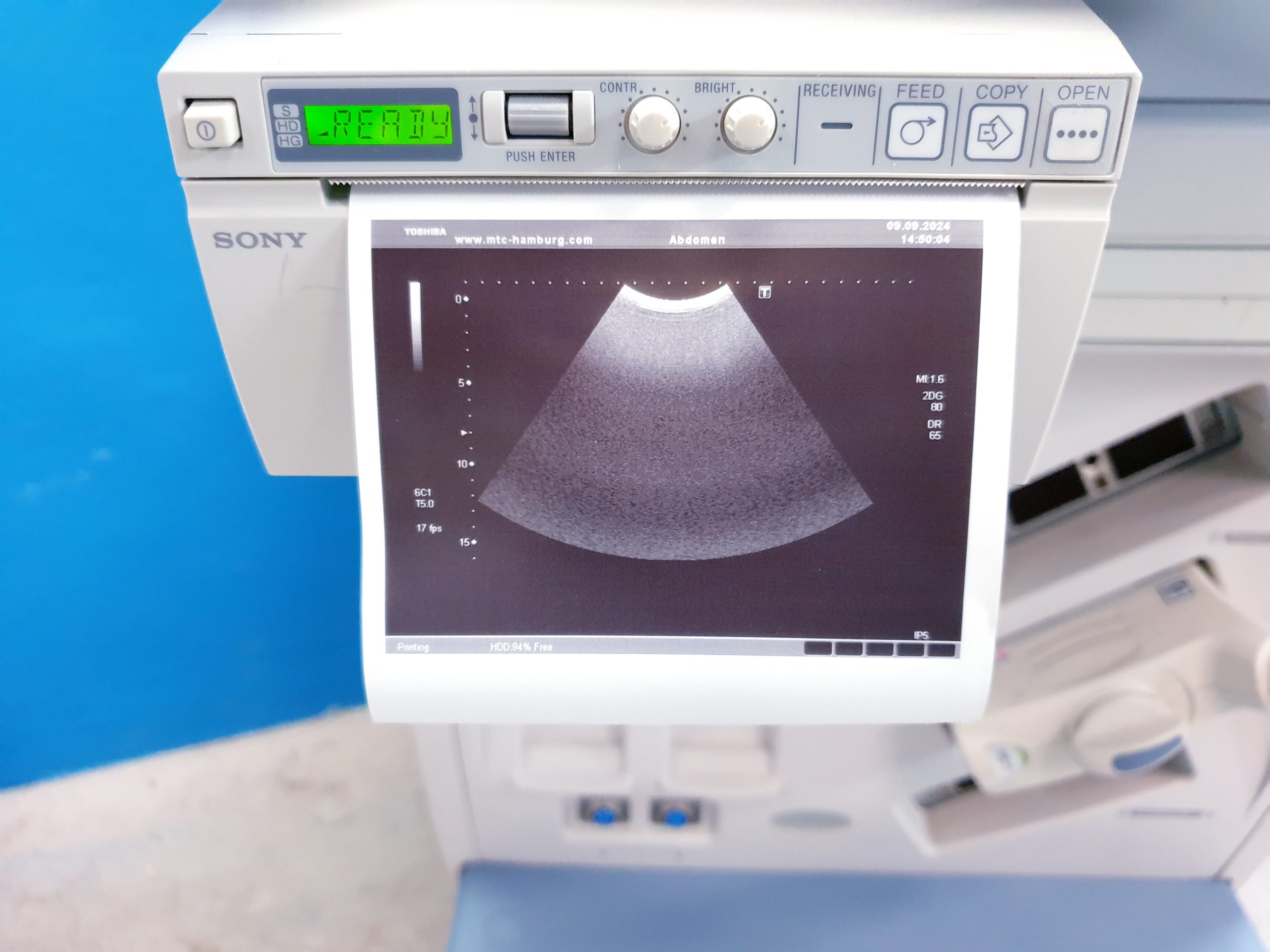 Toshiba PVT-375BT Ultraschallsonde – Konvex thumbnail 3