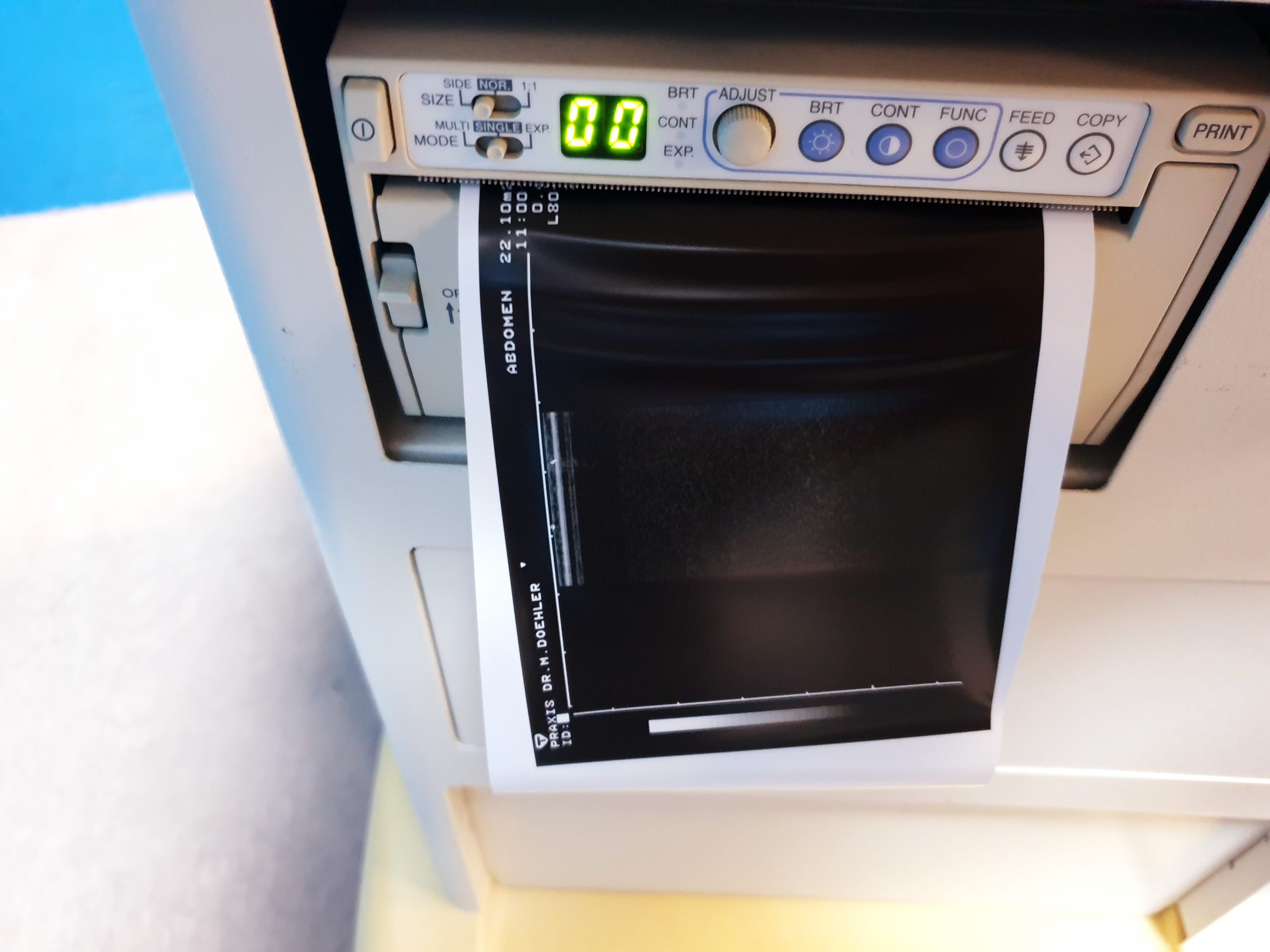 Toshiba Just Vision 400 Justvision 400 SSA-325 + Konvex + Linear thumbnail 8