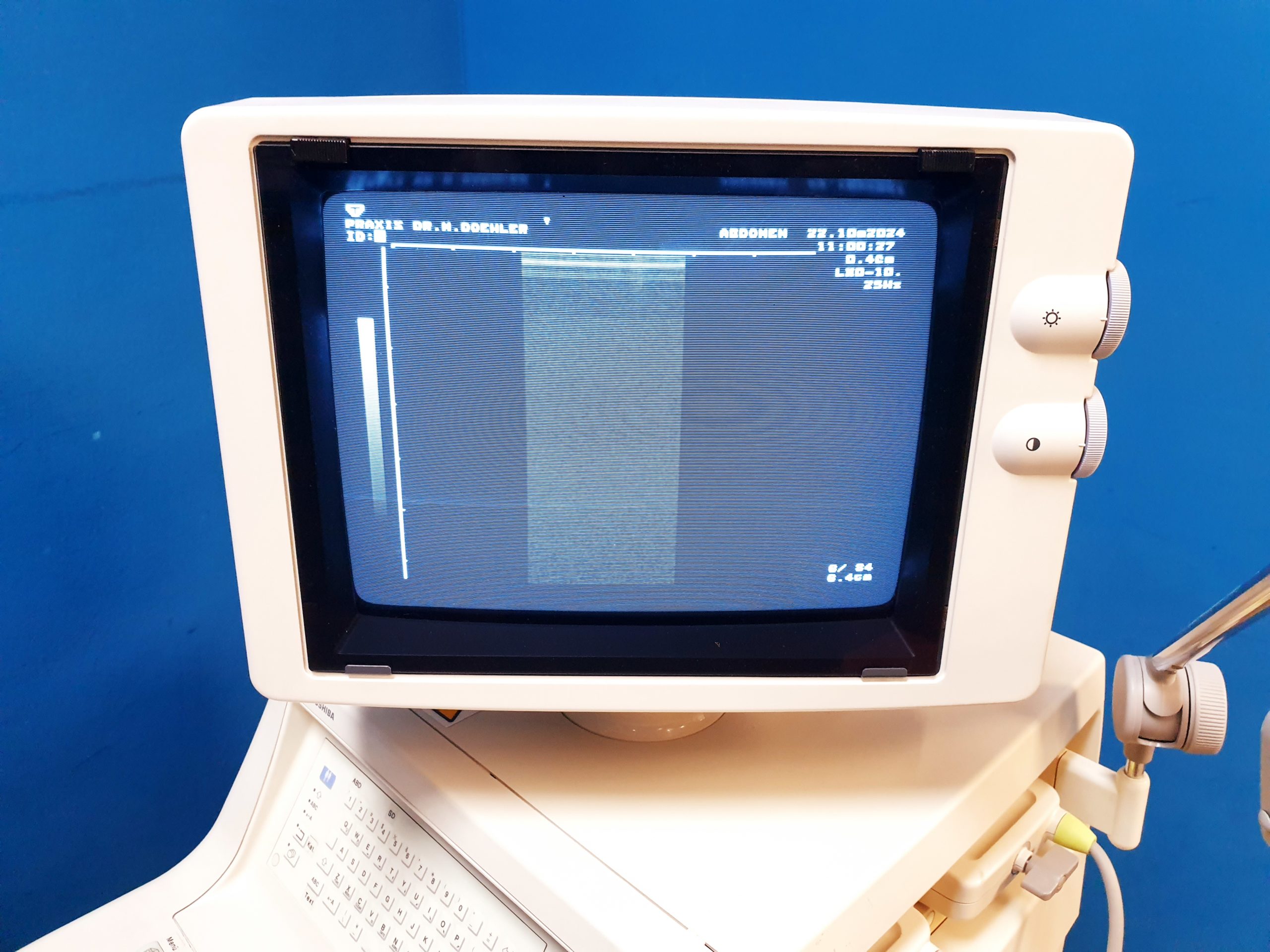 Toshiba Just Vision 400 Justvision 400 SSA-325 + Konvex + Linear thumbnail 13