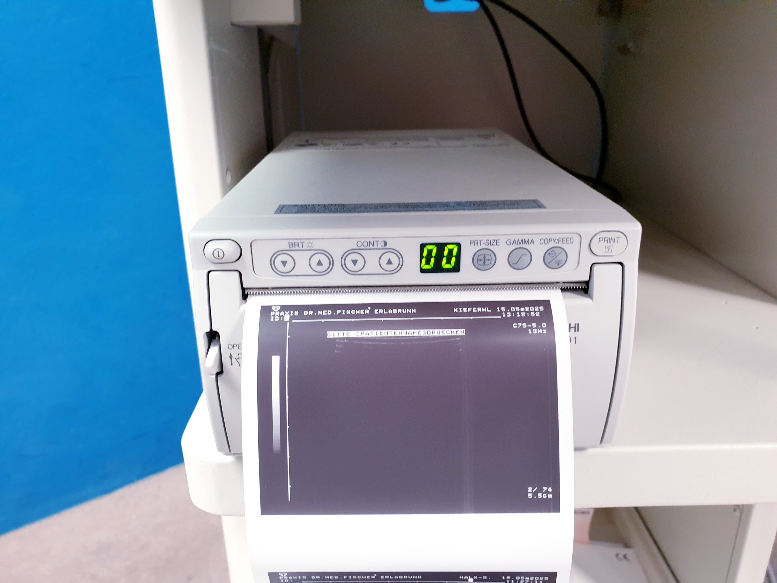 Toshiba Just Vision 400 Justvision 400 SSA-325 + Konvex + Linear thumbnail 30
