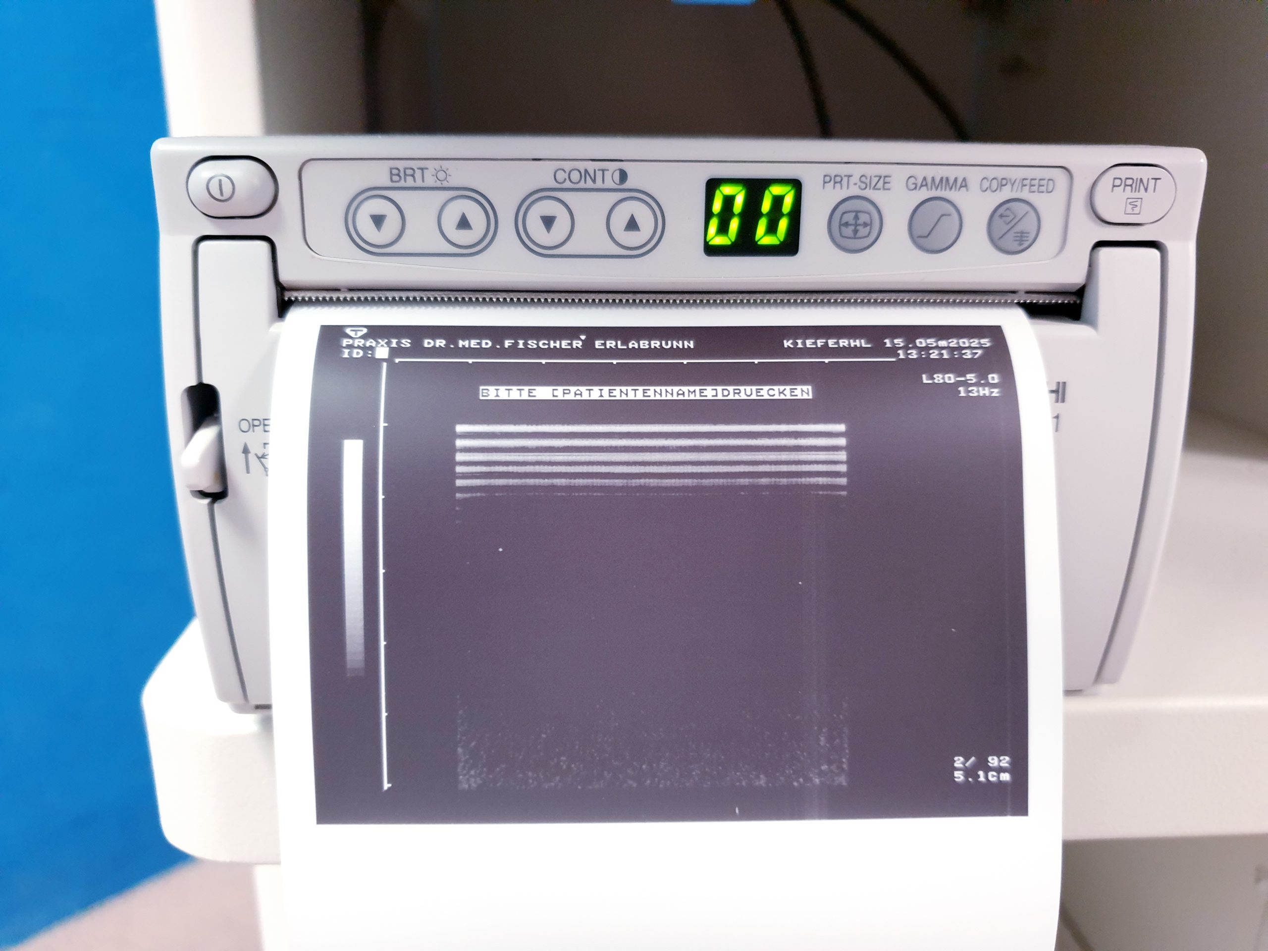 Toshiba Just Vision 400 Justvision 400 SSA-325 + Konvex + Linear thumbnail 35
