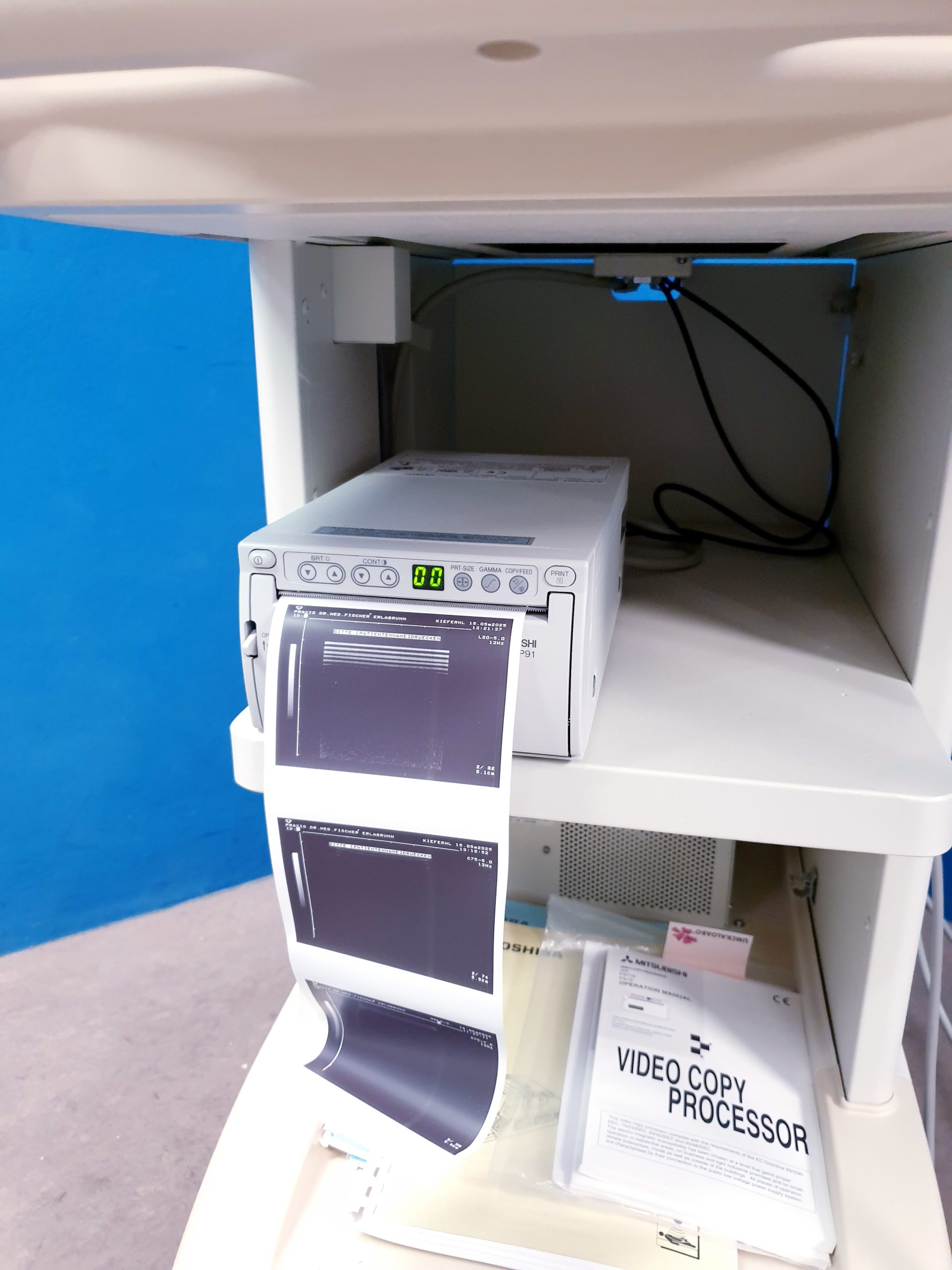 Toshiba Just Vision 400 Justvision 400 SSA-325 + Konvex + Linear thumbnail 36