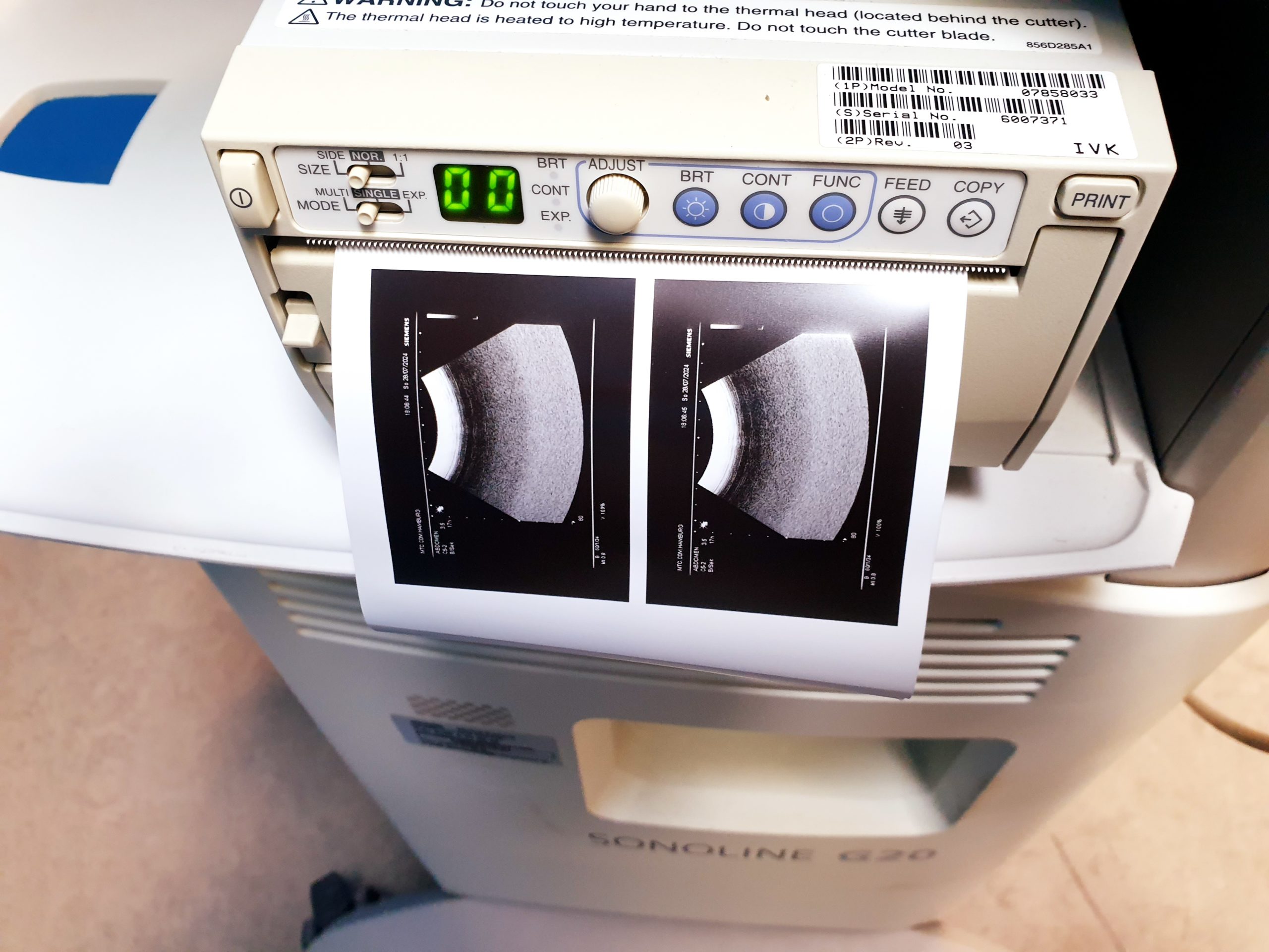 Siemens SONOLINE G20 SLC. 3.5 Konvex, 7.5 Linear thumbnail 5