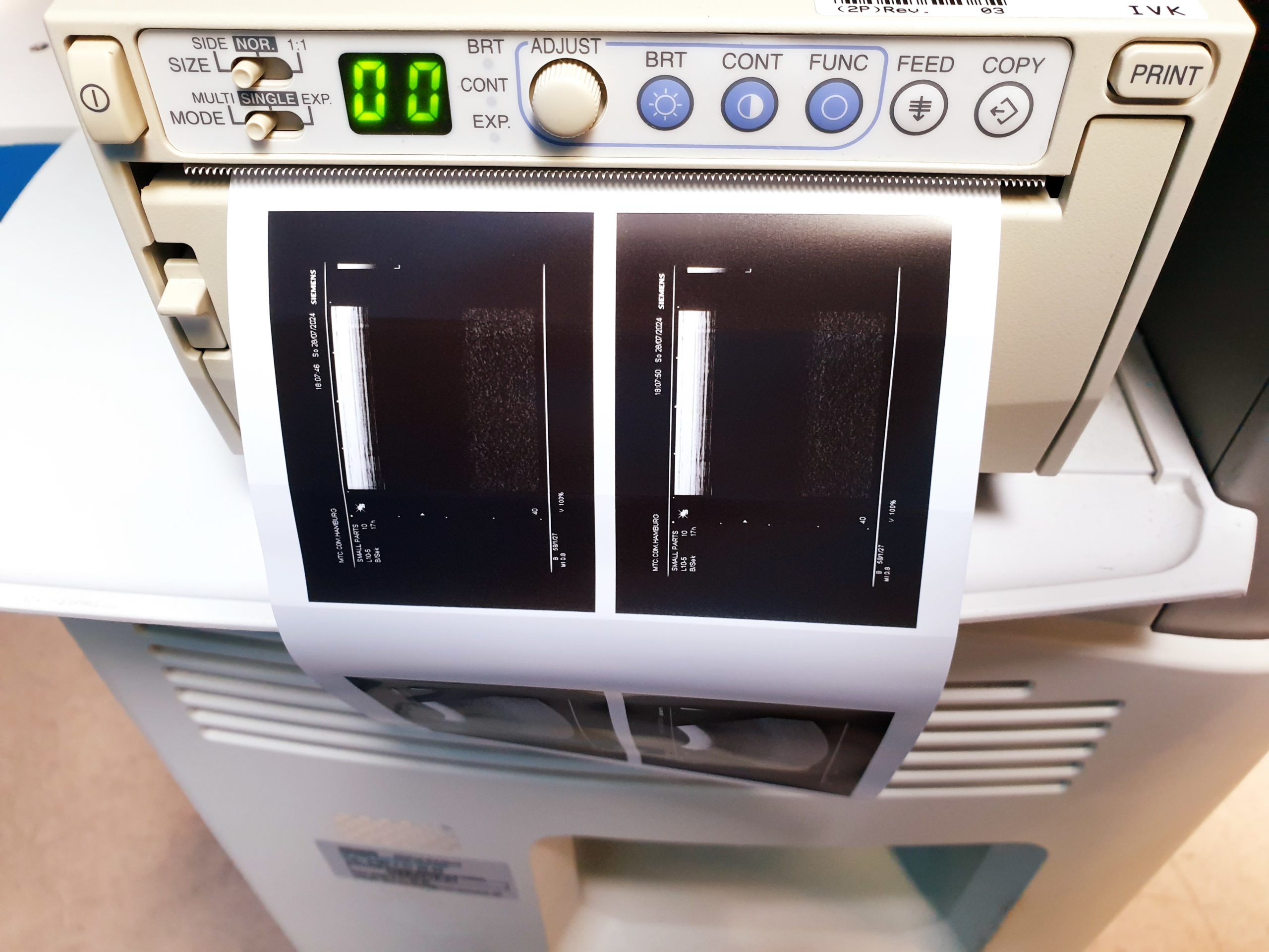 Siemens SONOLINE G20 SLC. 3.5 Konvex, 7.5 Linear thumbnail 8