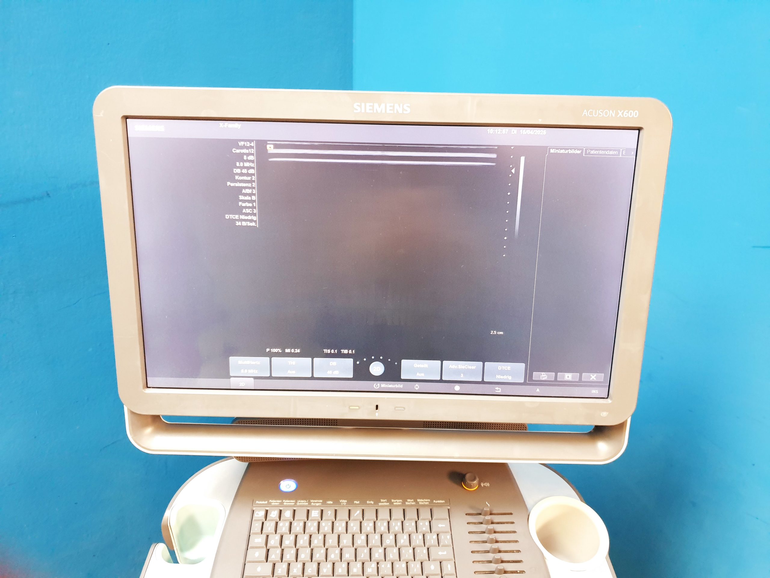 Siemens Acuson X600 Farbdoppler + CH5-2 Konvex + VF12-4 Linear thumbnail 7